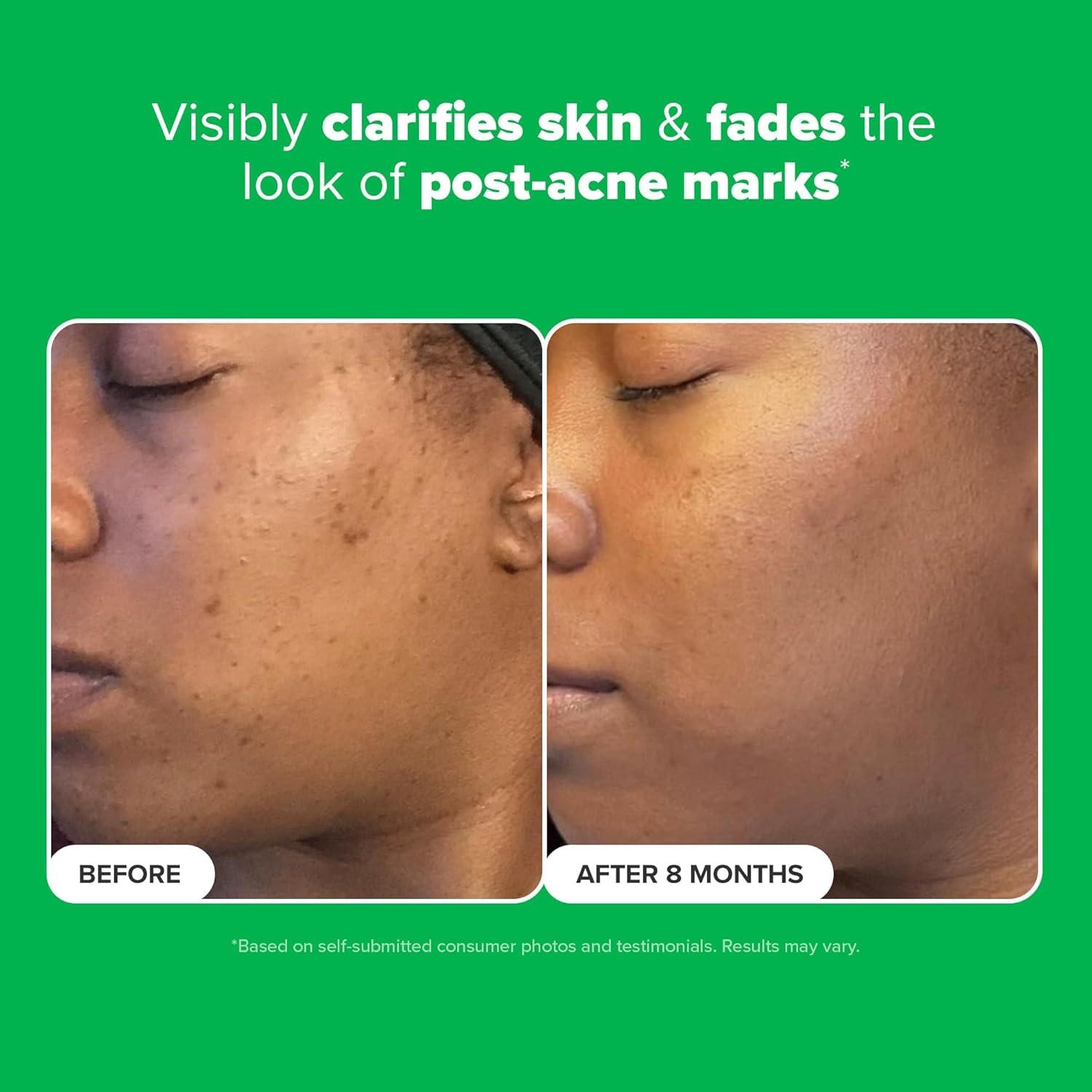 Crema Gel Booster Paula's Choice 10% Ácido Azelaico 28g