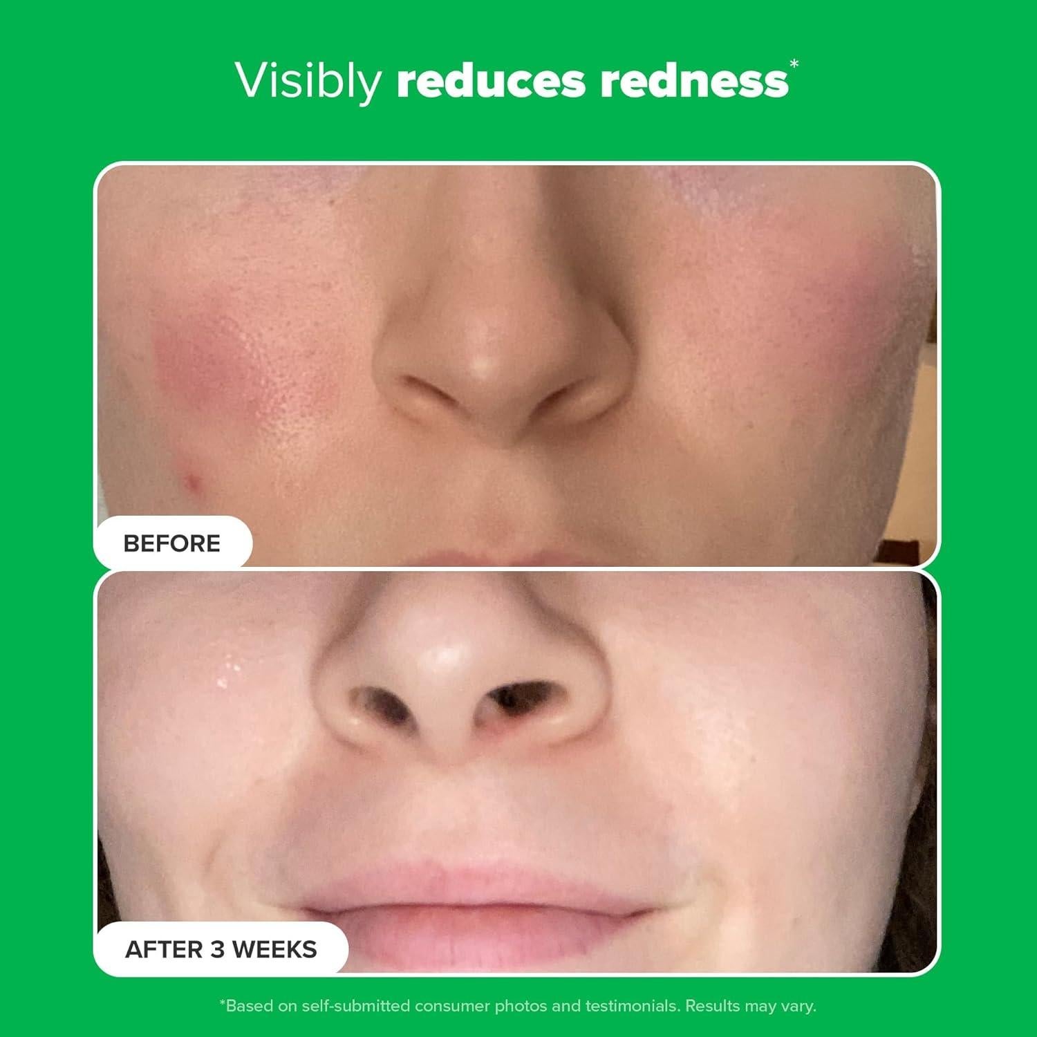 Crema Gel Booster Paula's Choice 10% Ácido Azelaico 28g