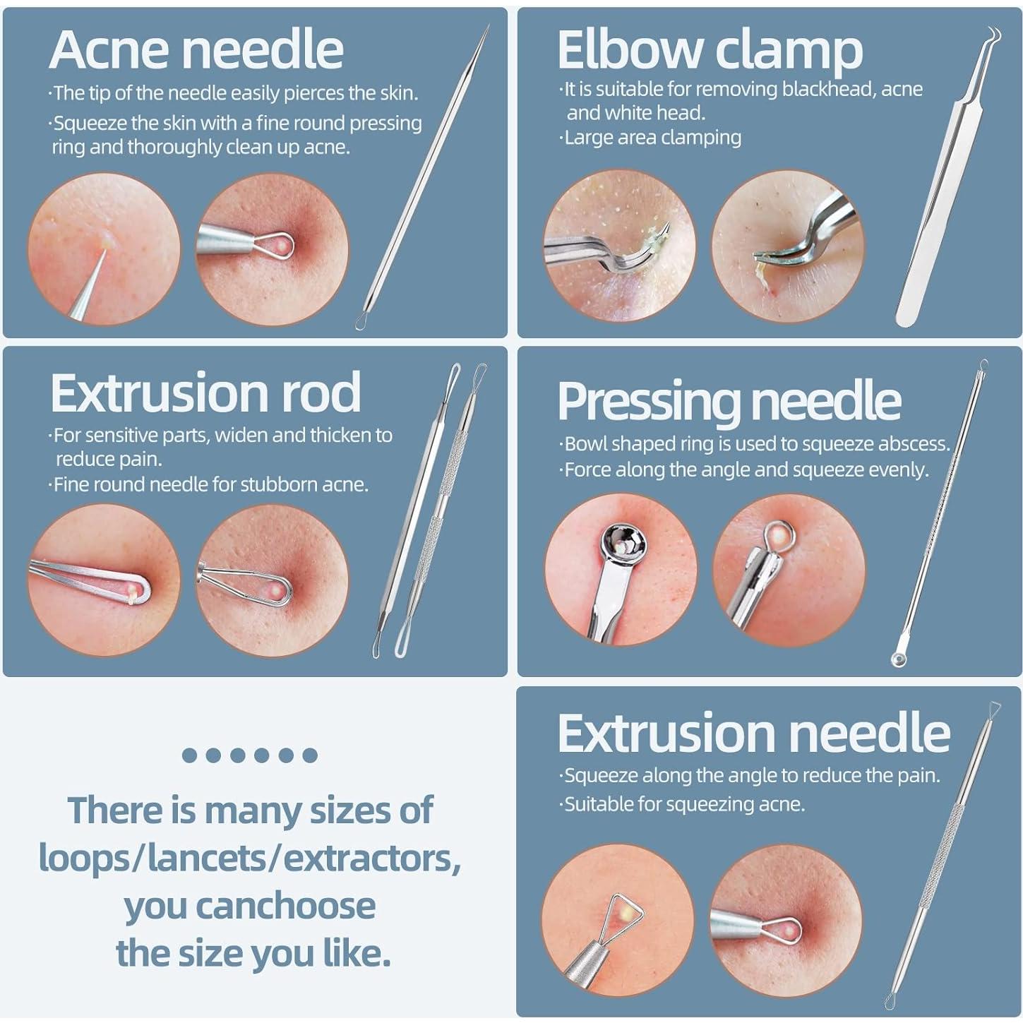 Kit Removedor de Puntos Negros JPNK 6 Piezas Acero Inoxidable