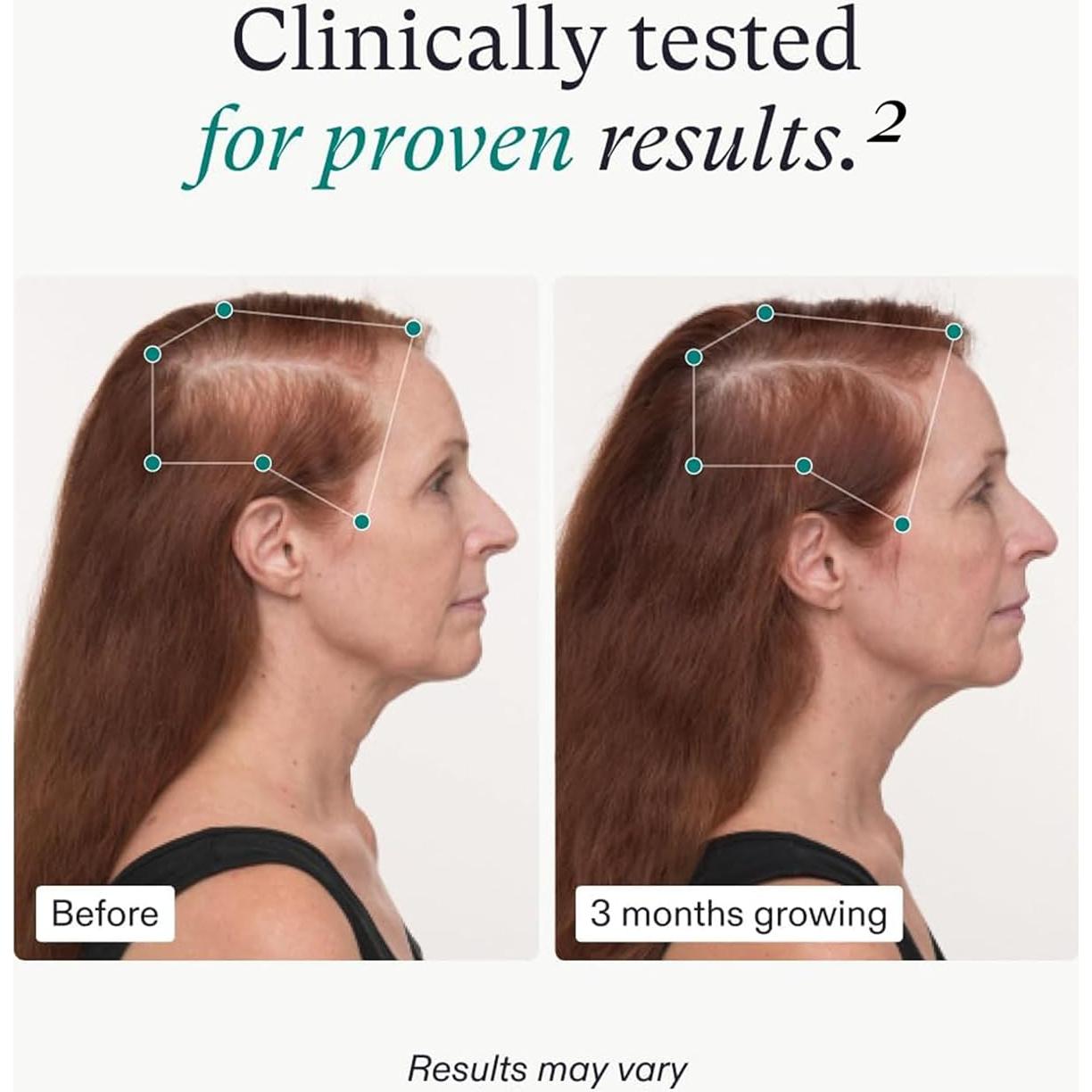 Suplemento Crecimiento Capilar Nutrafol Mujeres 45+ 1 Mes