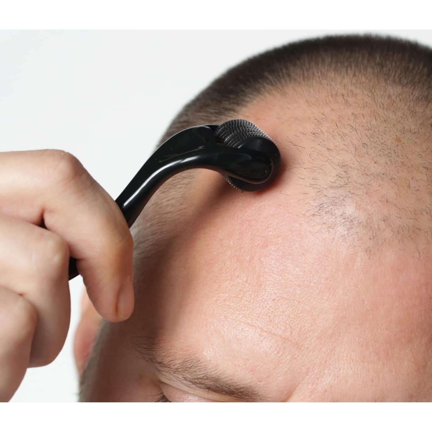 Derma Roller RoselynBoutique 540 Microagujas Titanio