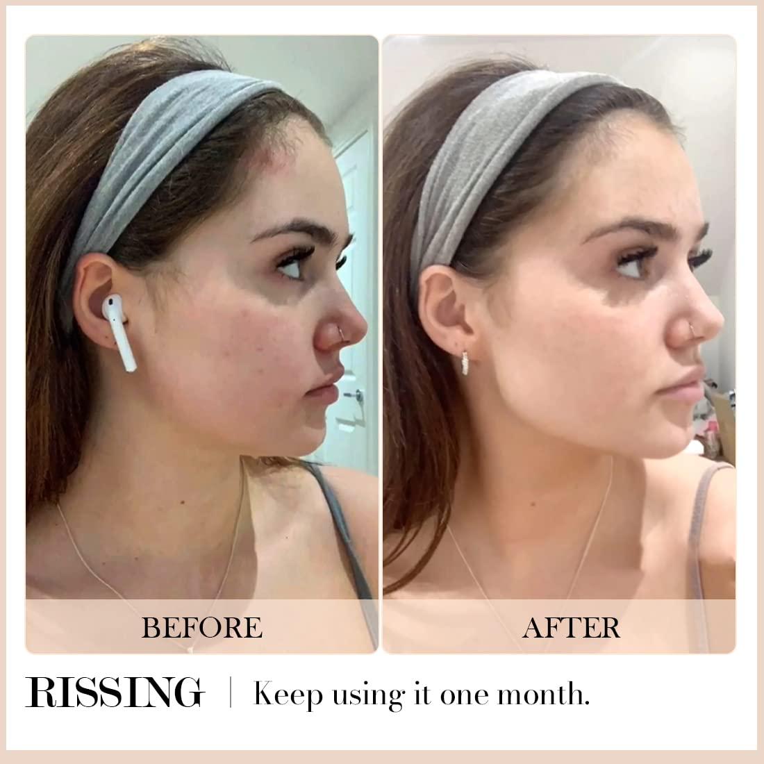 Gua Sha Facial RISSING 4-en-1 Acero Inoxidable Portátil