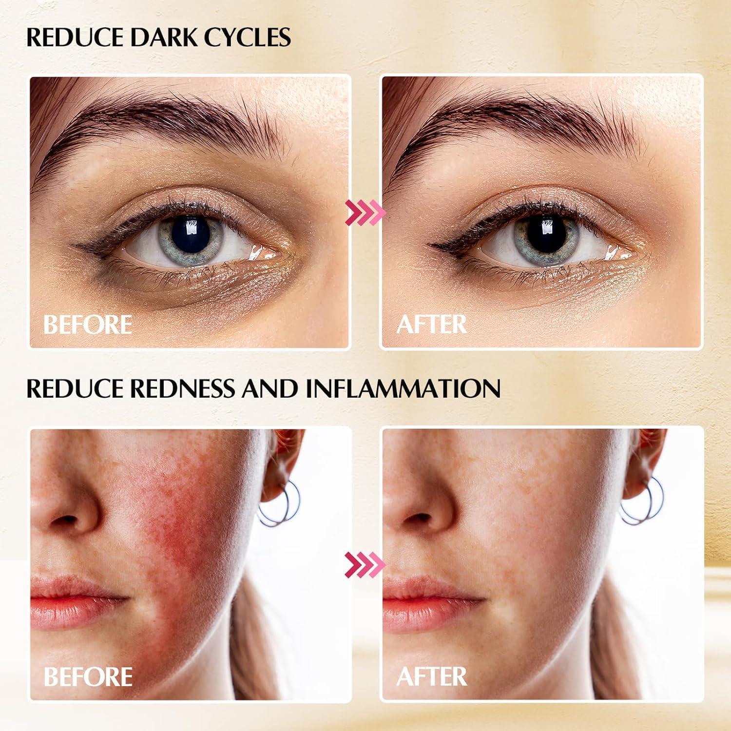 Herramientas Faciales Fabludo Gua Sha 3 en 1 Acero Inoxidable