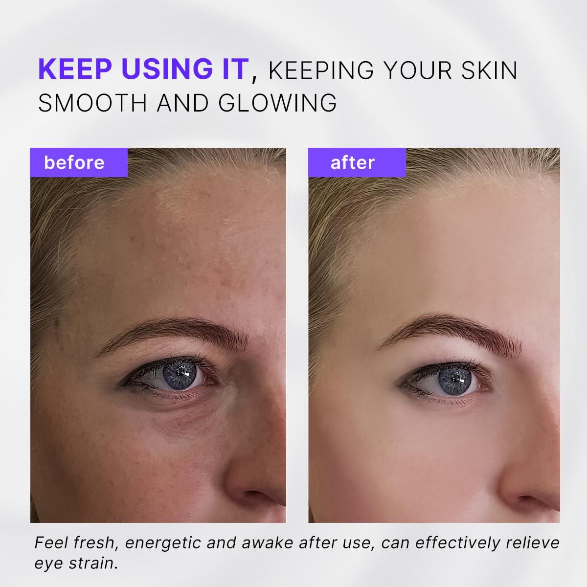 Aplicador de Crema para Ojos QooWo 2 en 1 con Rodillo Frío