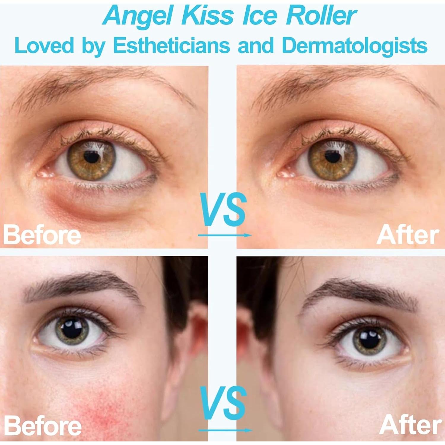 Rodillo de Hielo Angel Kiss S20 para Cara y Ojos