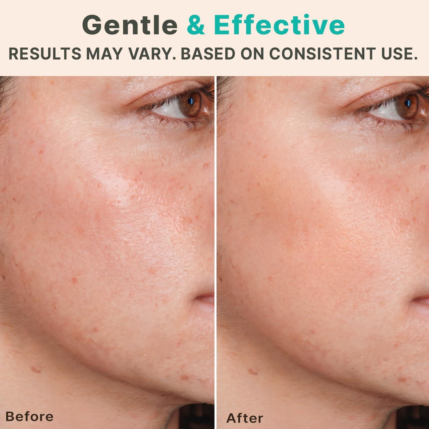 Rodillo Derma Beauty by Earth 0.25mm para Piel y Barba