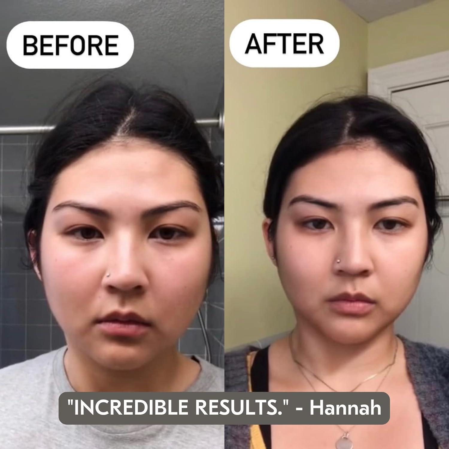 Conjunto Spa Facial Mount Lai Cuarzo Rosa Gua Sha y Rodillo