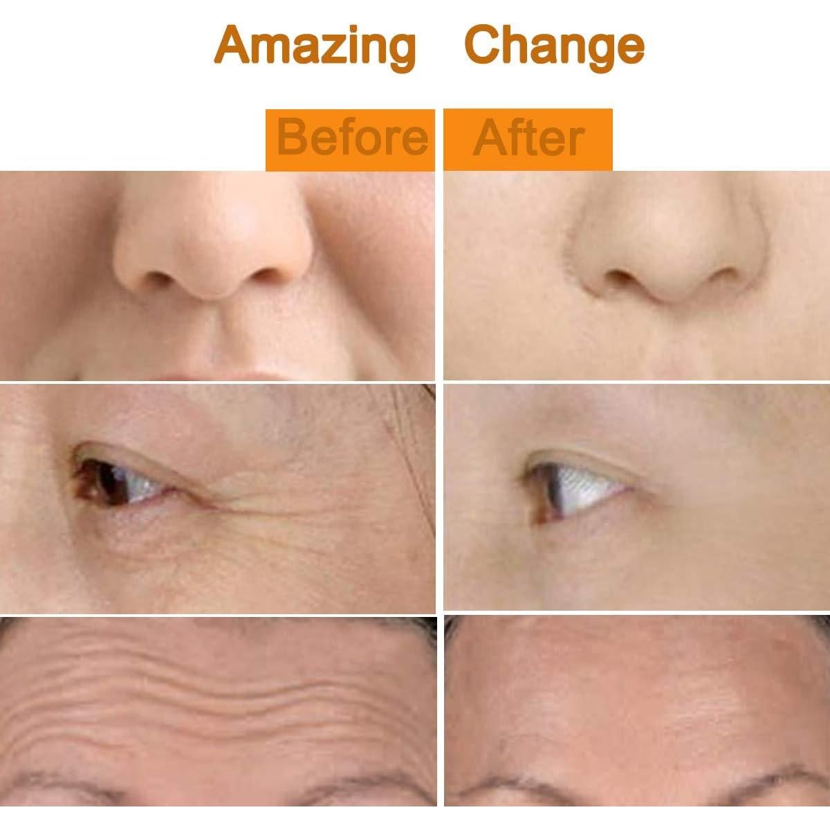 Masajeador Facial Eléctrico Yeamon 2 en 1 Rodillo 3D y T