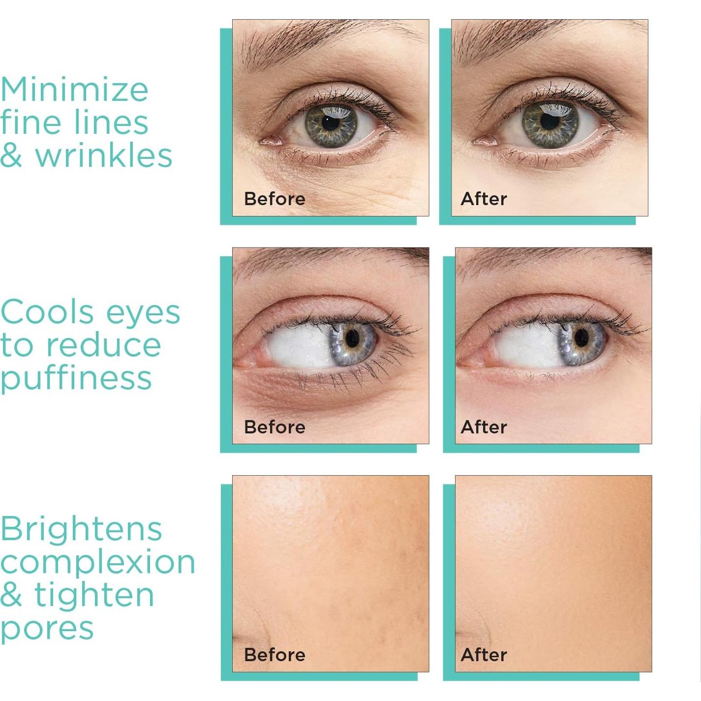 Esferas de Hielo MonetBeauty para Facial - Azul - Antienvejecimiento