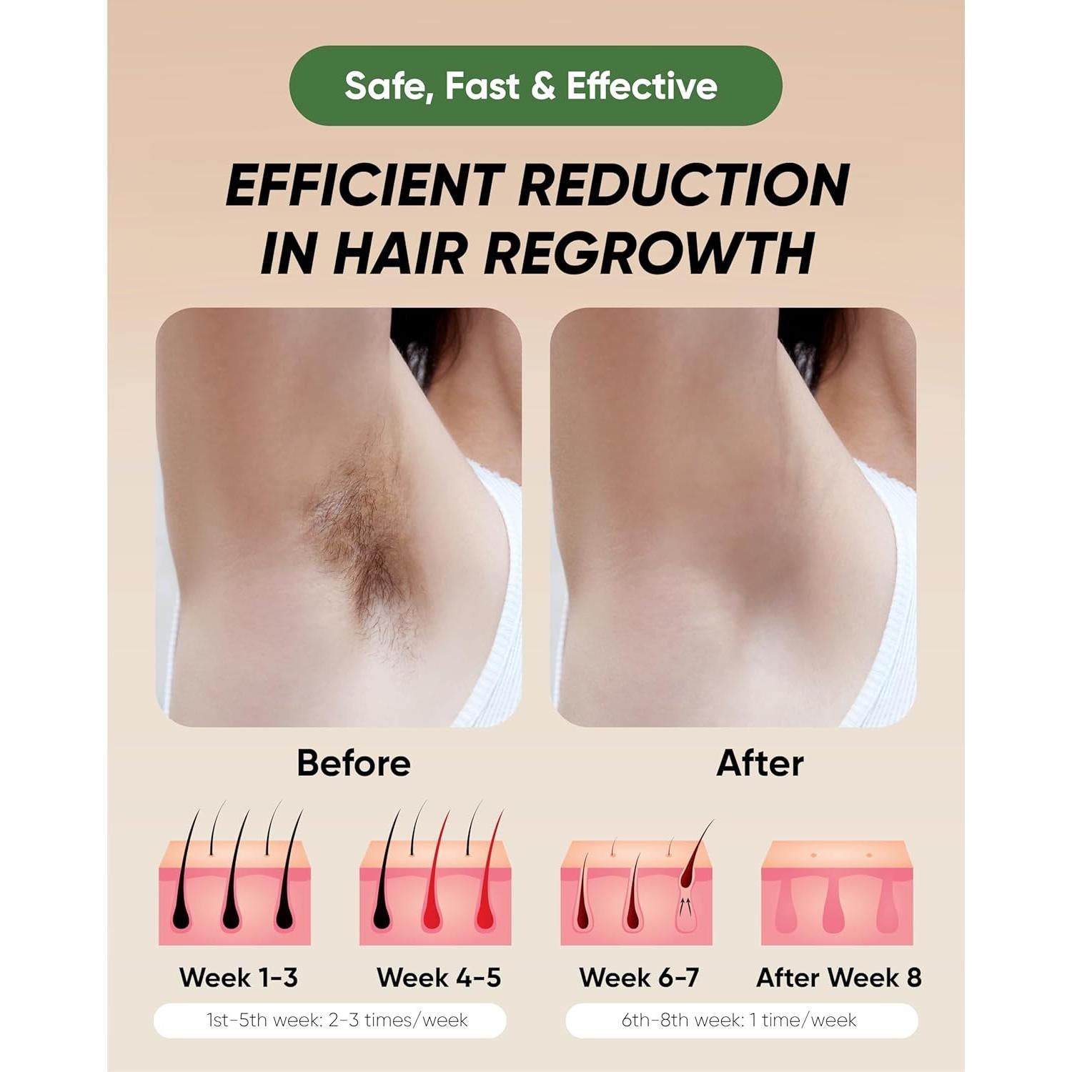 Eliminador de Vello IPL XSOUL 999999 Destellos Indoloro