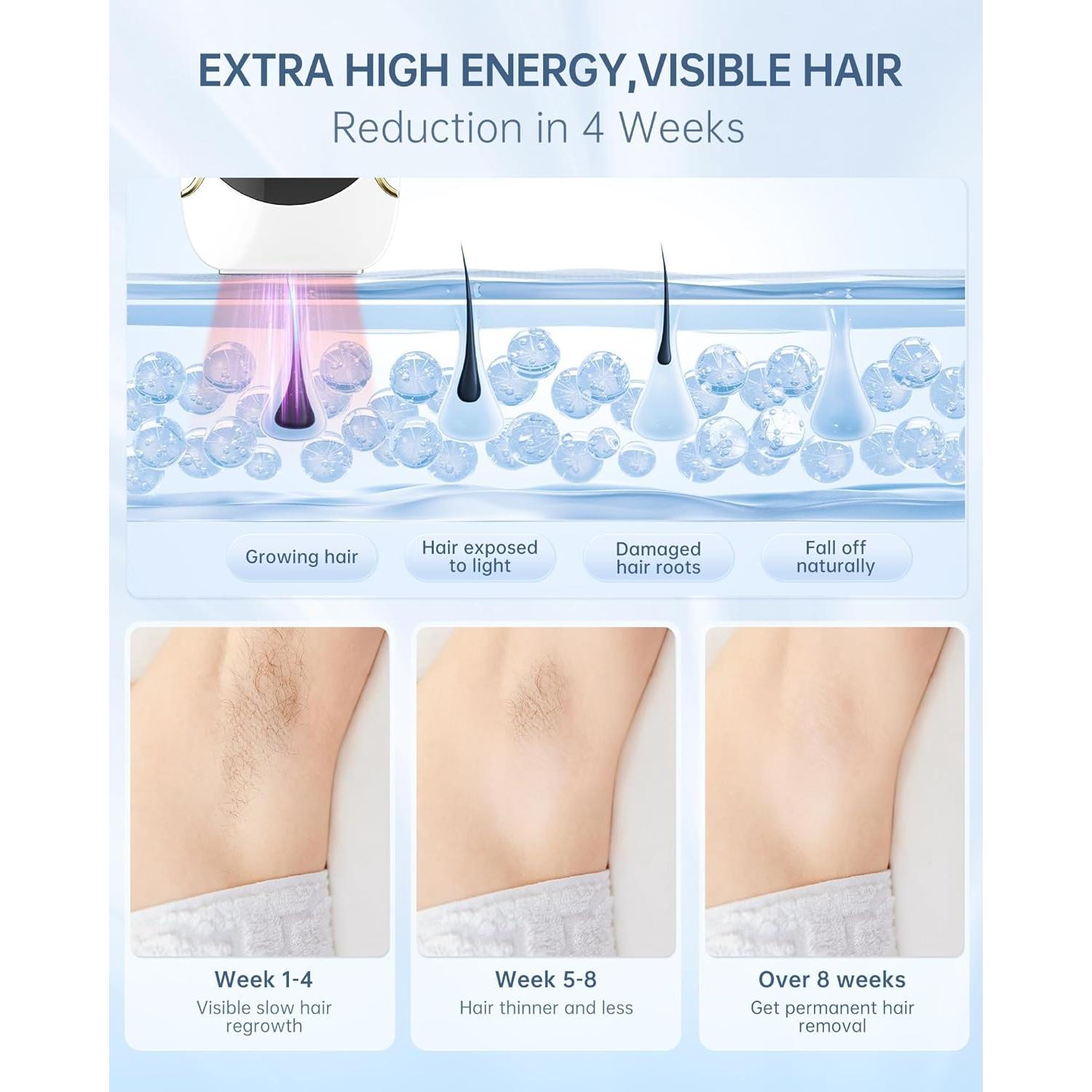 Eliminador de Vello Láser Finequin Air 15 IPL con Enfriamiento