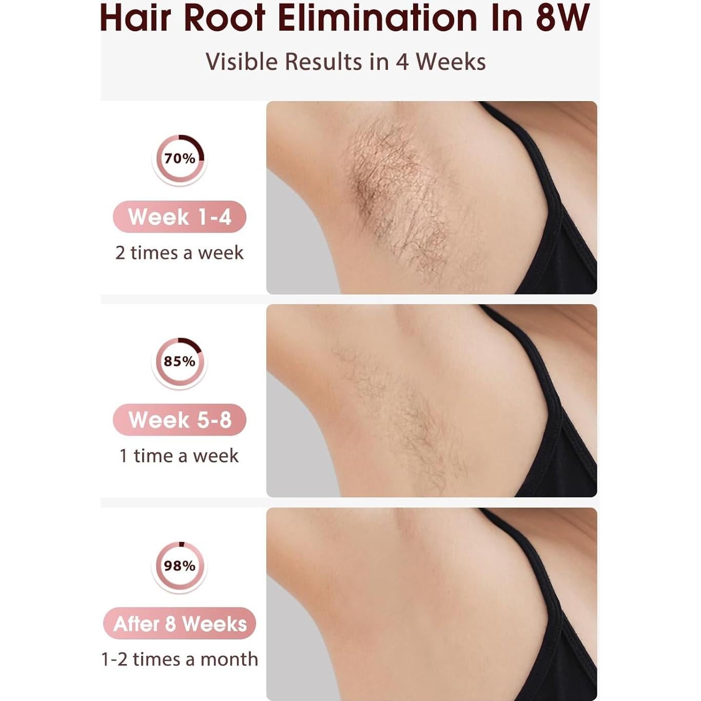 Depiladora Láser IPL LYSMOSKI Oro Rosa, Indolora y Rápida