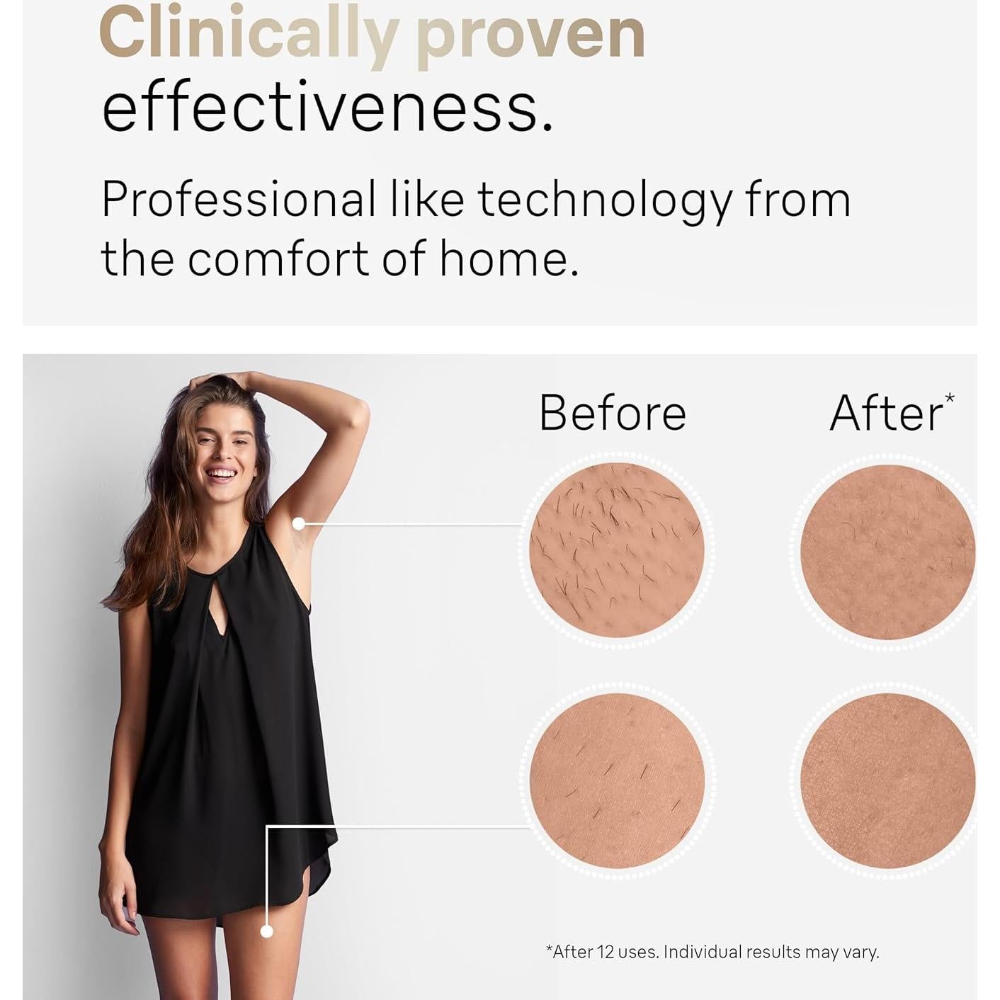 Depiladora láser IPL Braun Silk Expert Pro 5 PL5137 con maquinilla