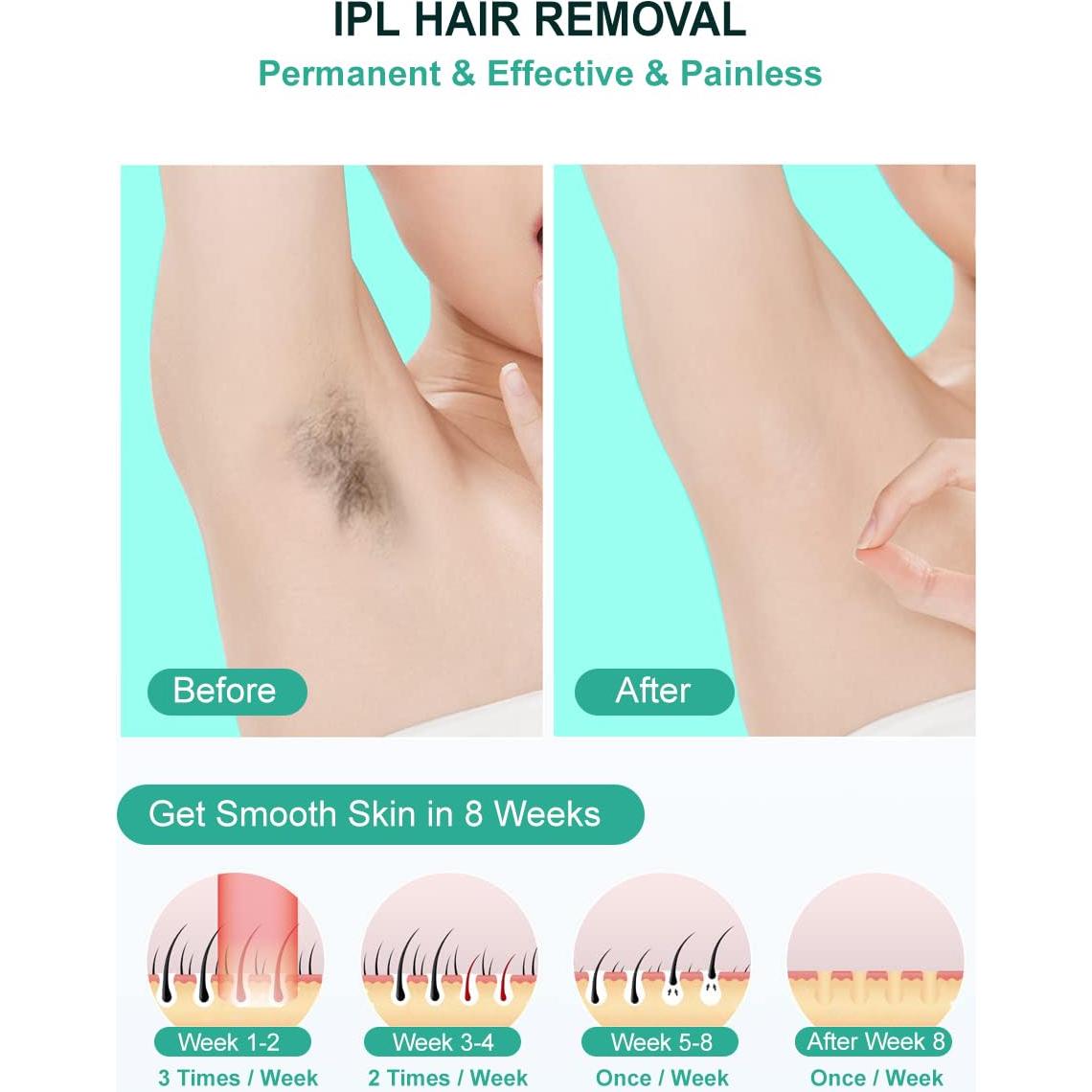 Dispositivo IPL BAIWEN 999999 destellos depilación en casa