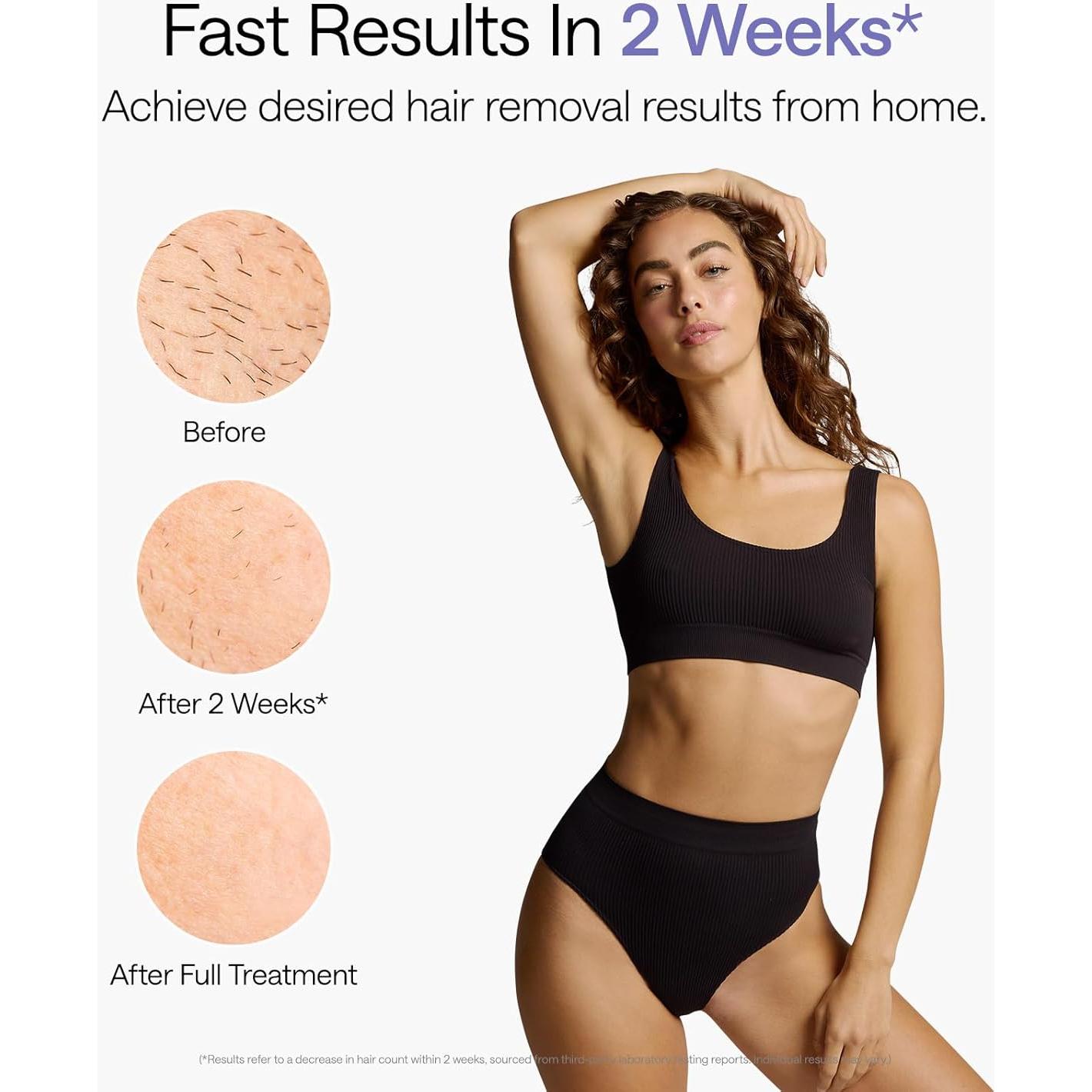 Ulike Depilación Láser Air 10 IPL para Mujeres y Hombres