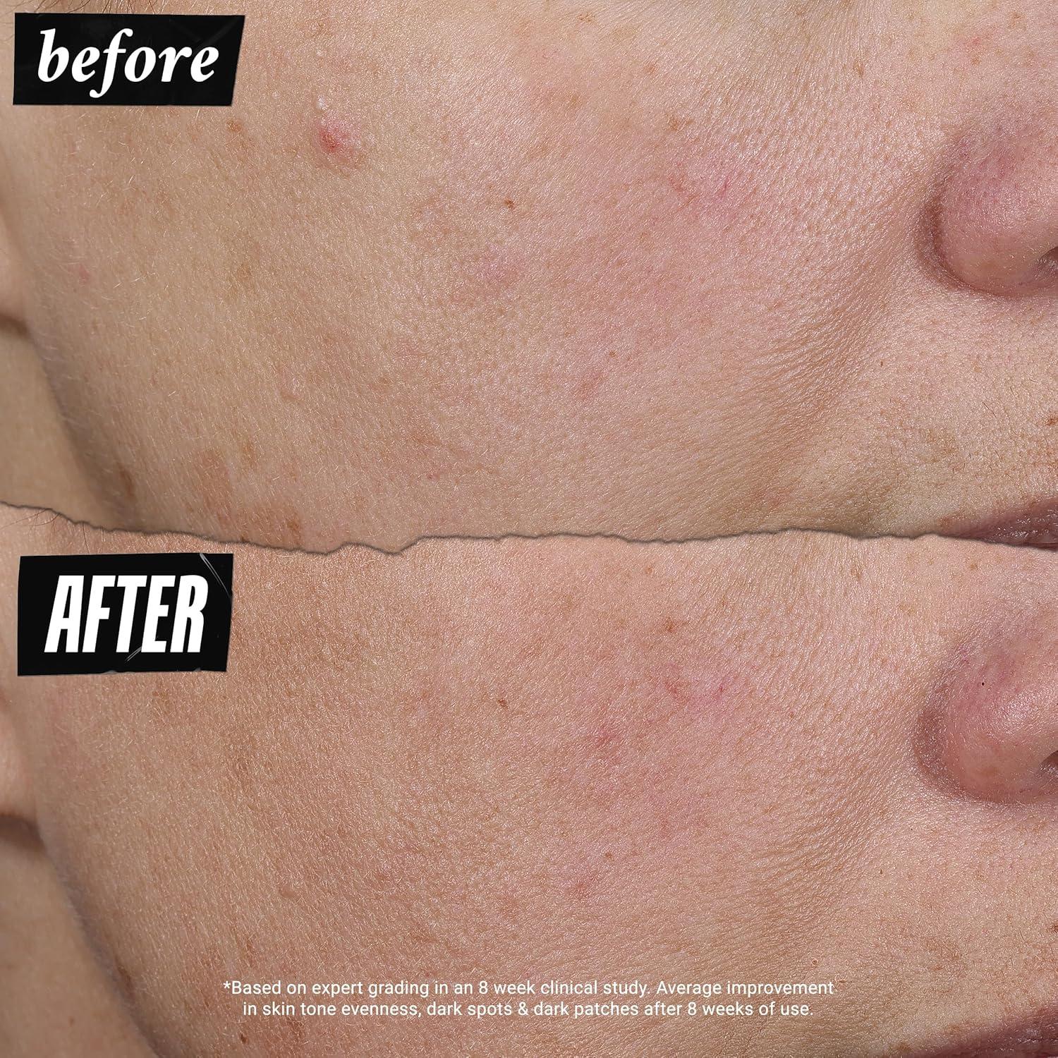 Suero Corrector de Color Kiehl's Auto-Tone SPF 30 15 cm