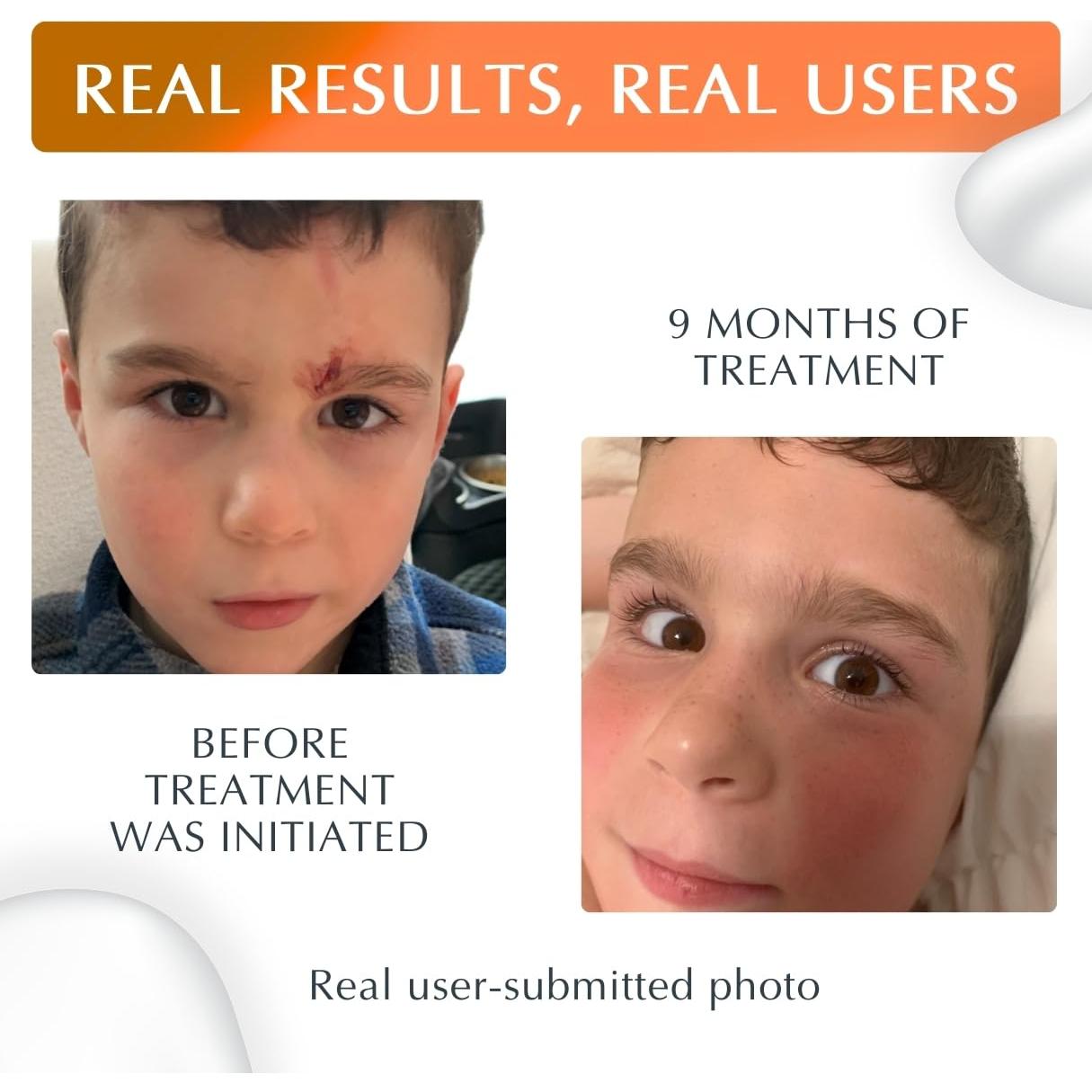 Gel de Silicona NewGel Plus UV 15g con Protector Solar SPF30