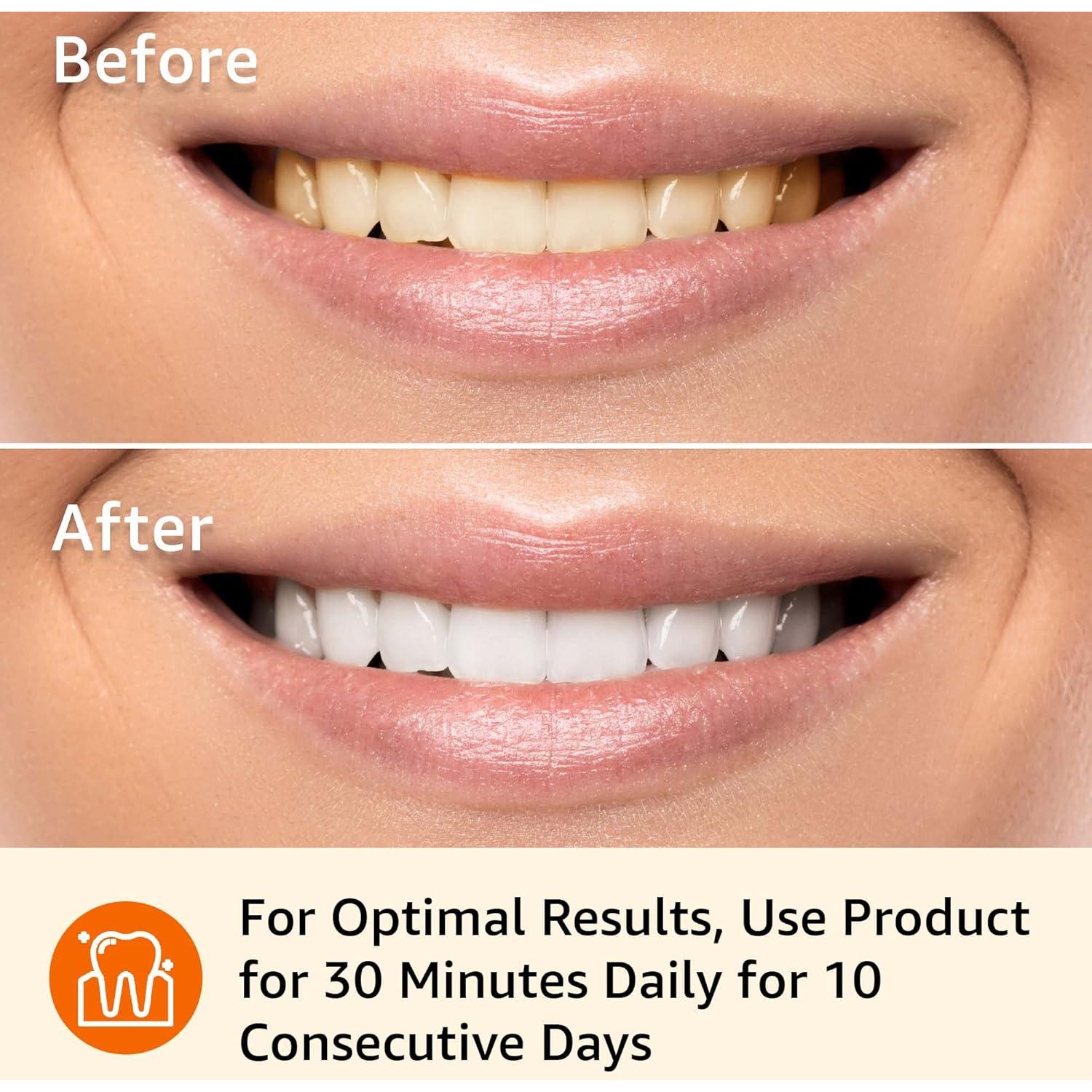 Kit de Tiras Blanqueadoras de Dientes Amazon Basics 10 Días