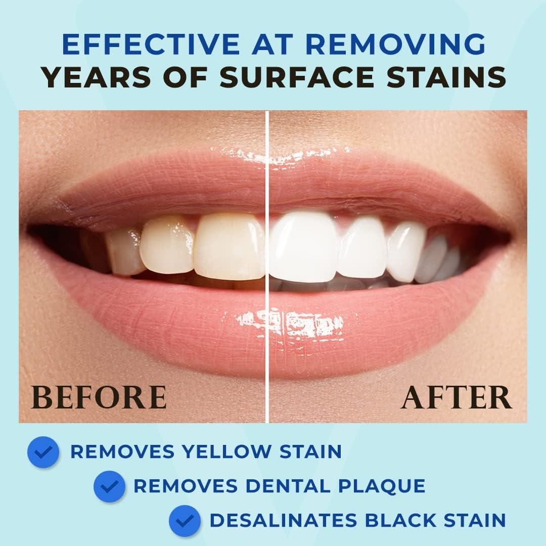 Pluma Blanqueadora de Dientes Venus Visage - 20+ Usos