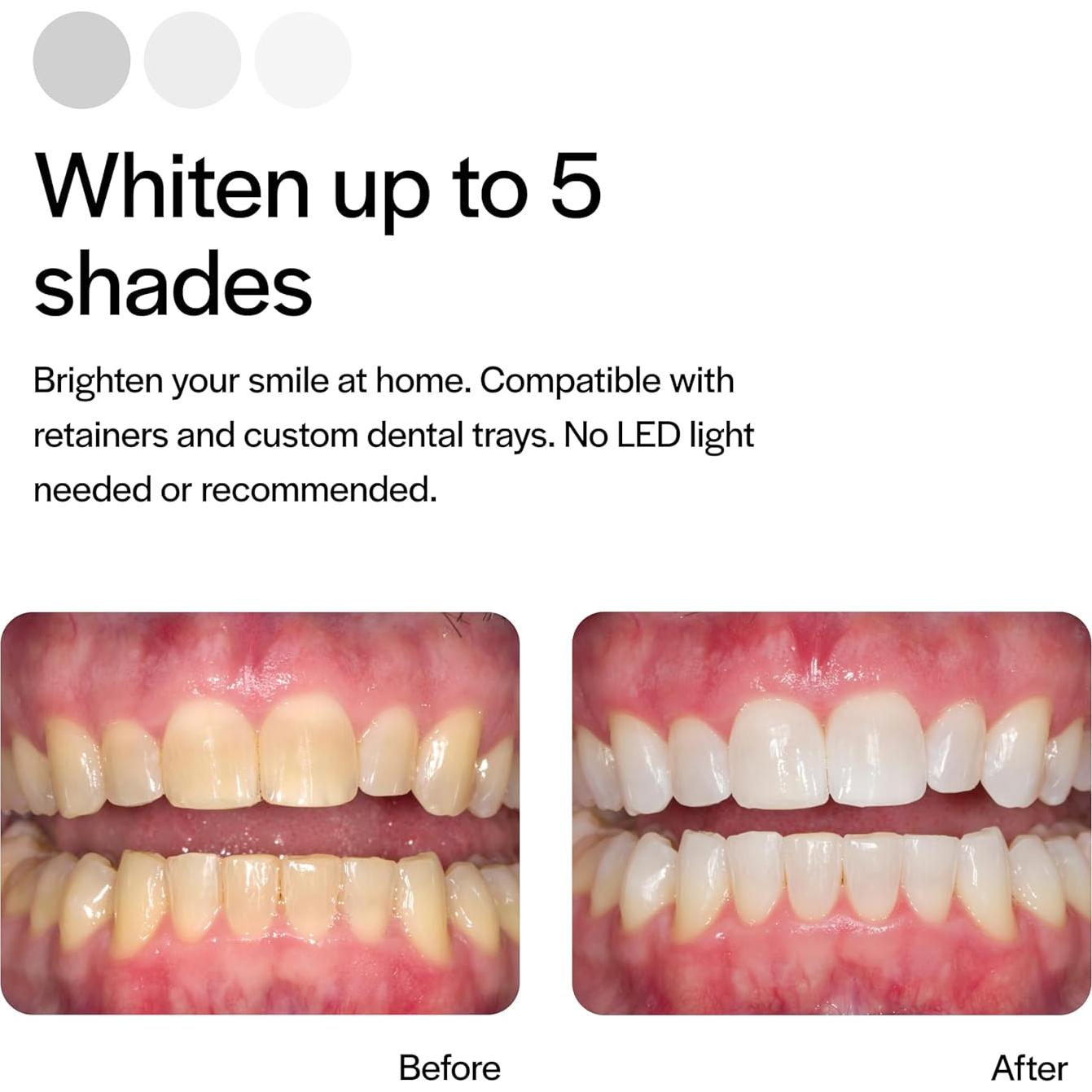 Gel Blanqueador Dental Opalescence 35% Menta - 4 Jeringas