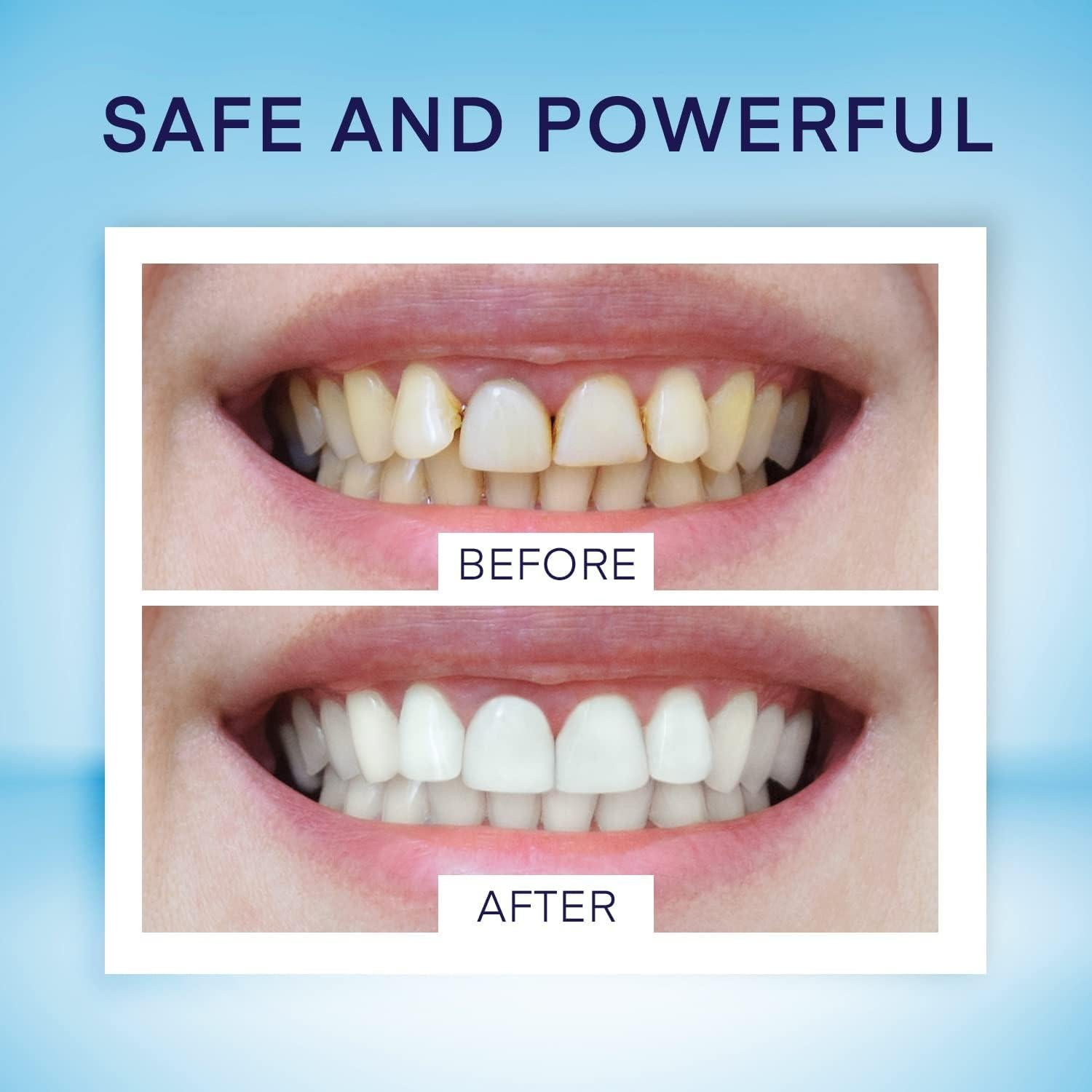 Bolígrafo Blanqueador de Dientes AsaVea 40+ Usos Menta