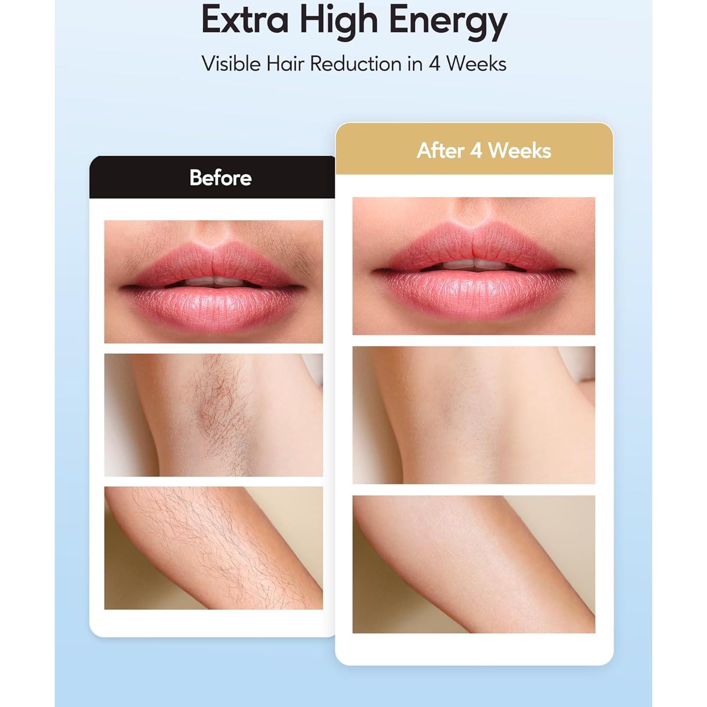 Depilador IPL INNZA Oro Rosa 999,999 destellos Indoloro