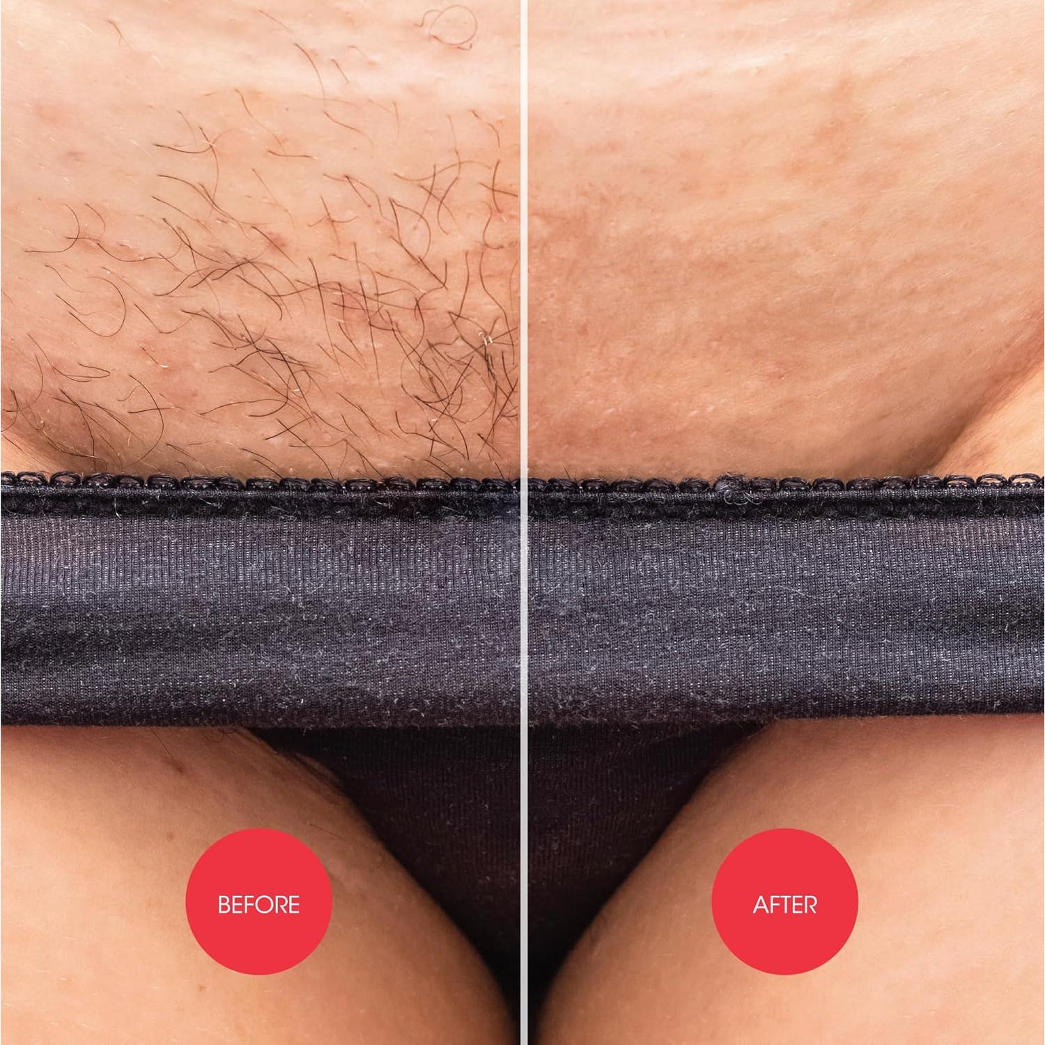 Crema Depilatoria Intima Nad's Down Under 150 ml