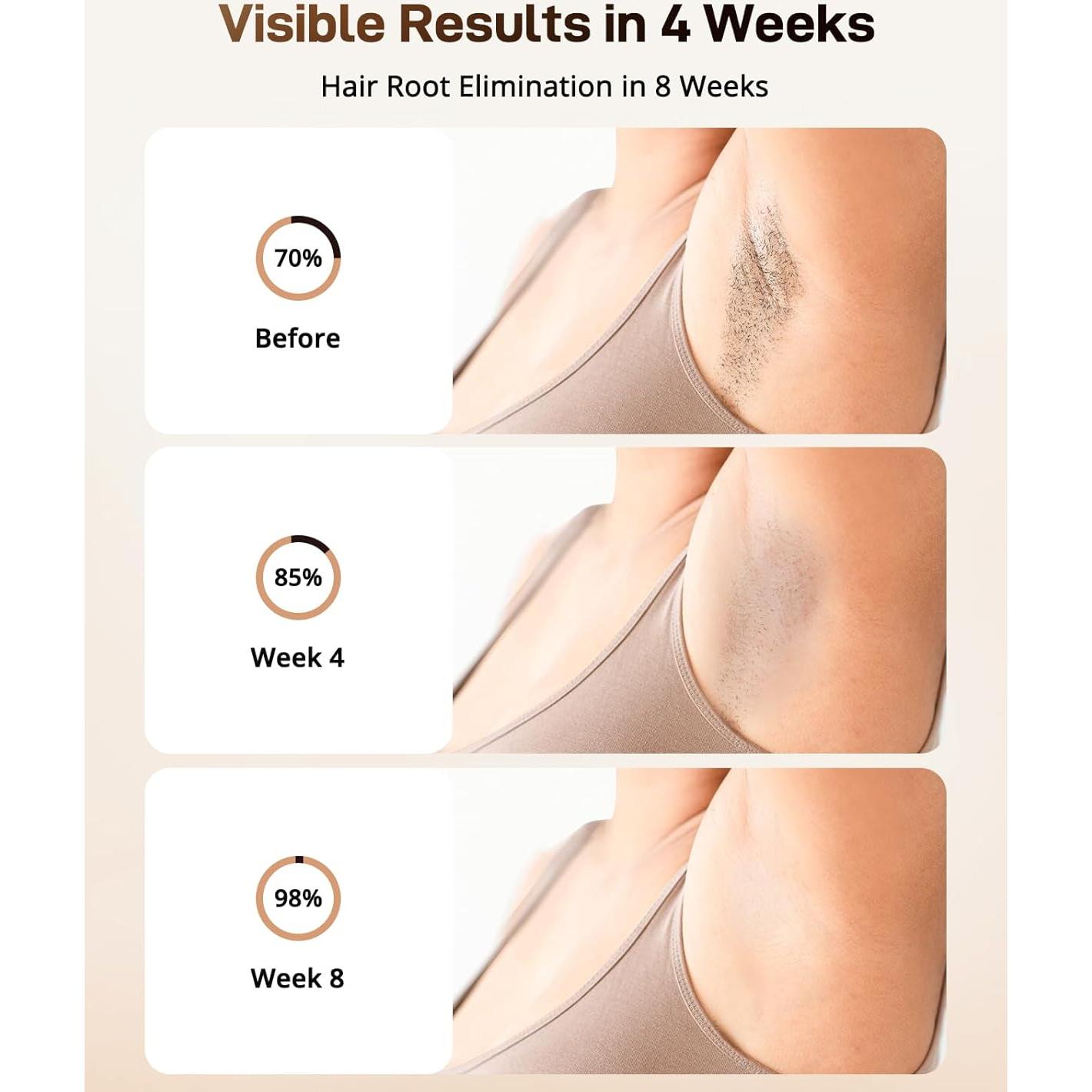 Depiladora Láser IPL LYSMOSKI 3 en 1 con Enfriamiento 9 Niveles