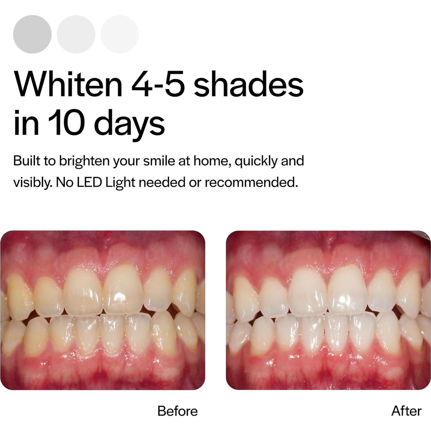 Kit Blanqueamiento Dental Opalescence 15% - 4 Tratamientos