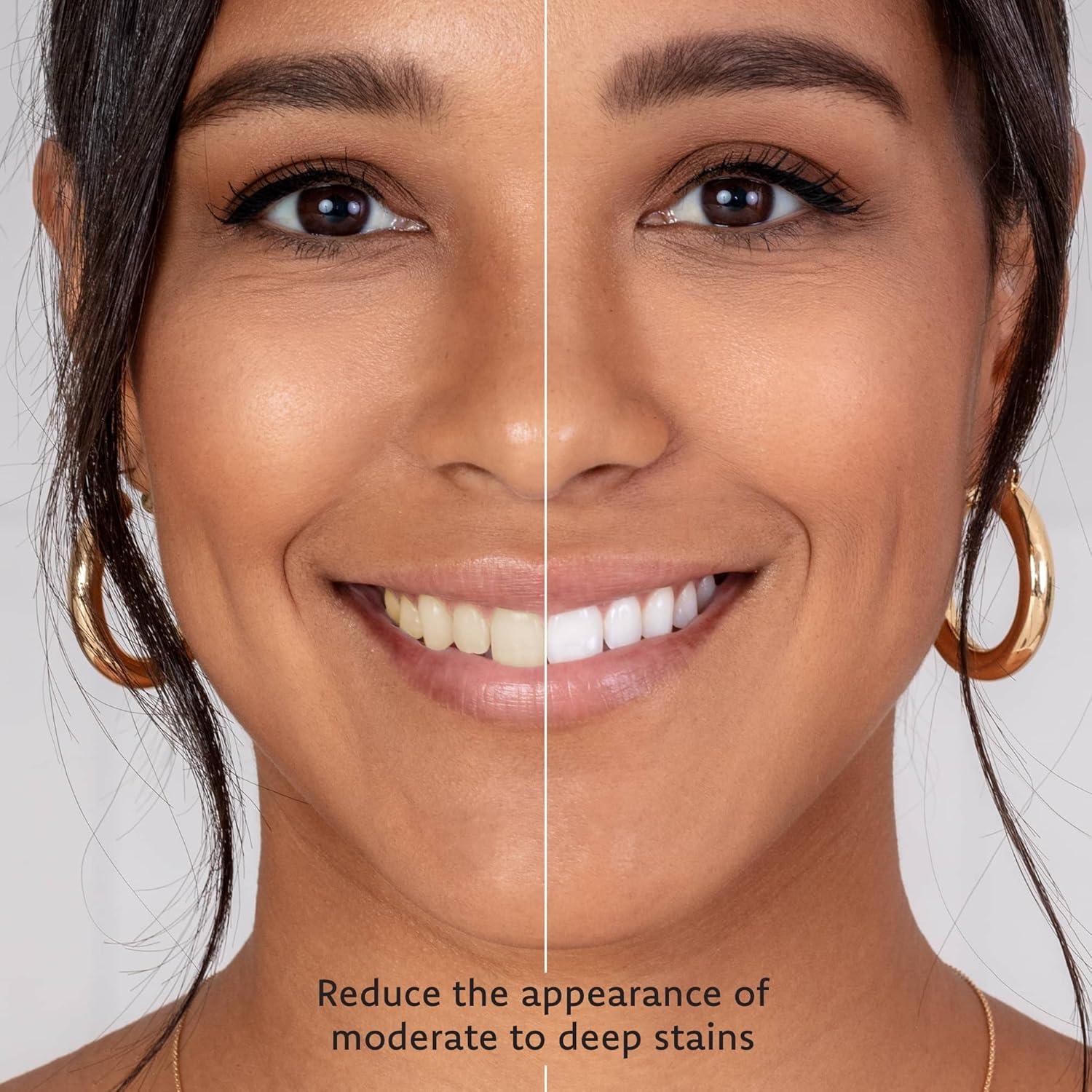 Gel Blanqueador Dental Everest VAAS 4 Jeringas 35% Peróxido