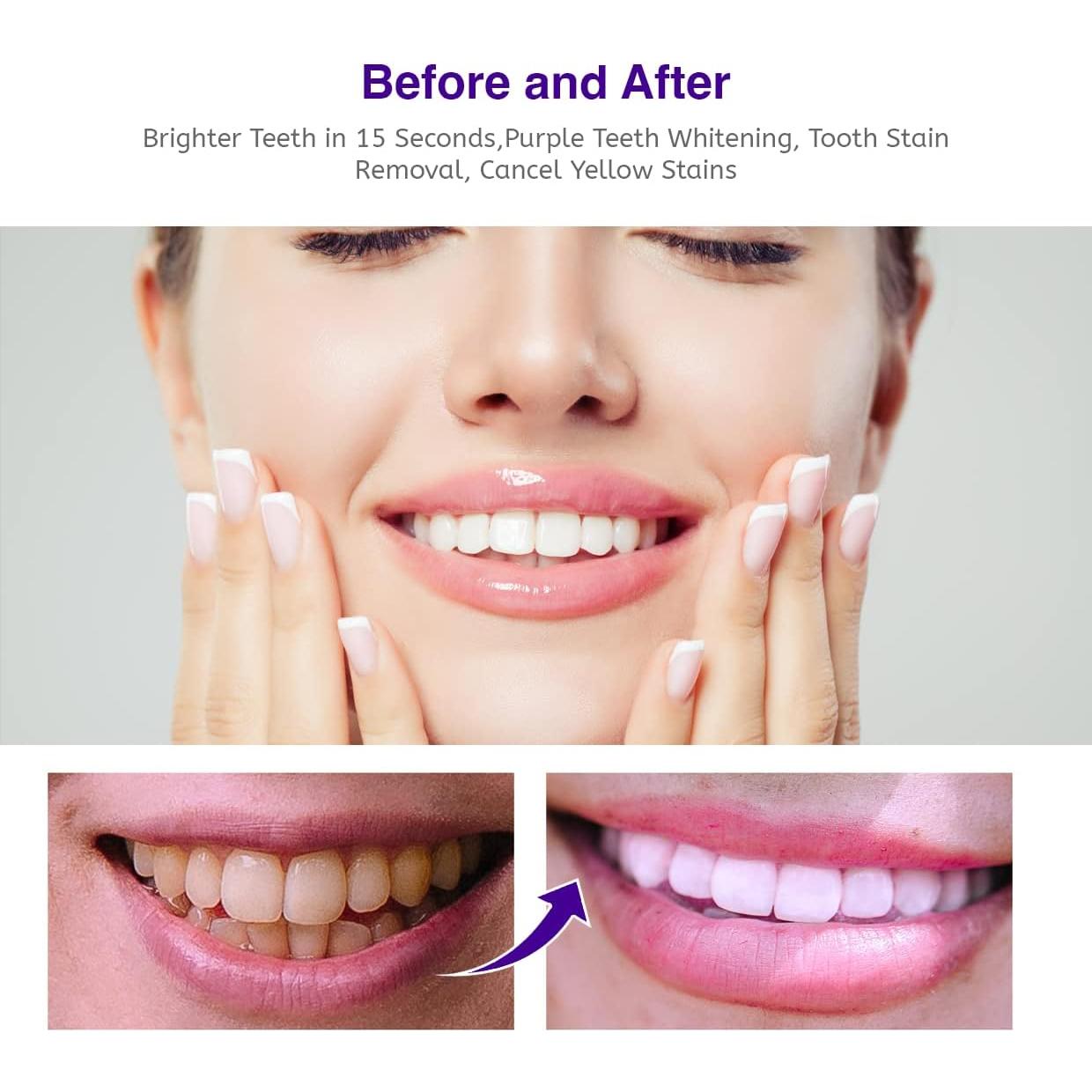 Purple Teeth Whitening, Tooth Stain Removal, Teeth Whitening Booster, Purple Whitening Tooth Foam, Purple Toothpaste（50ml）