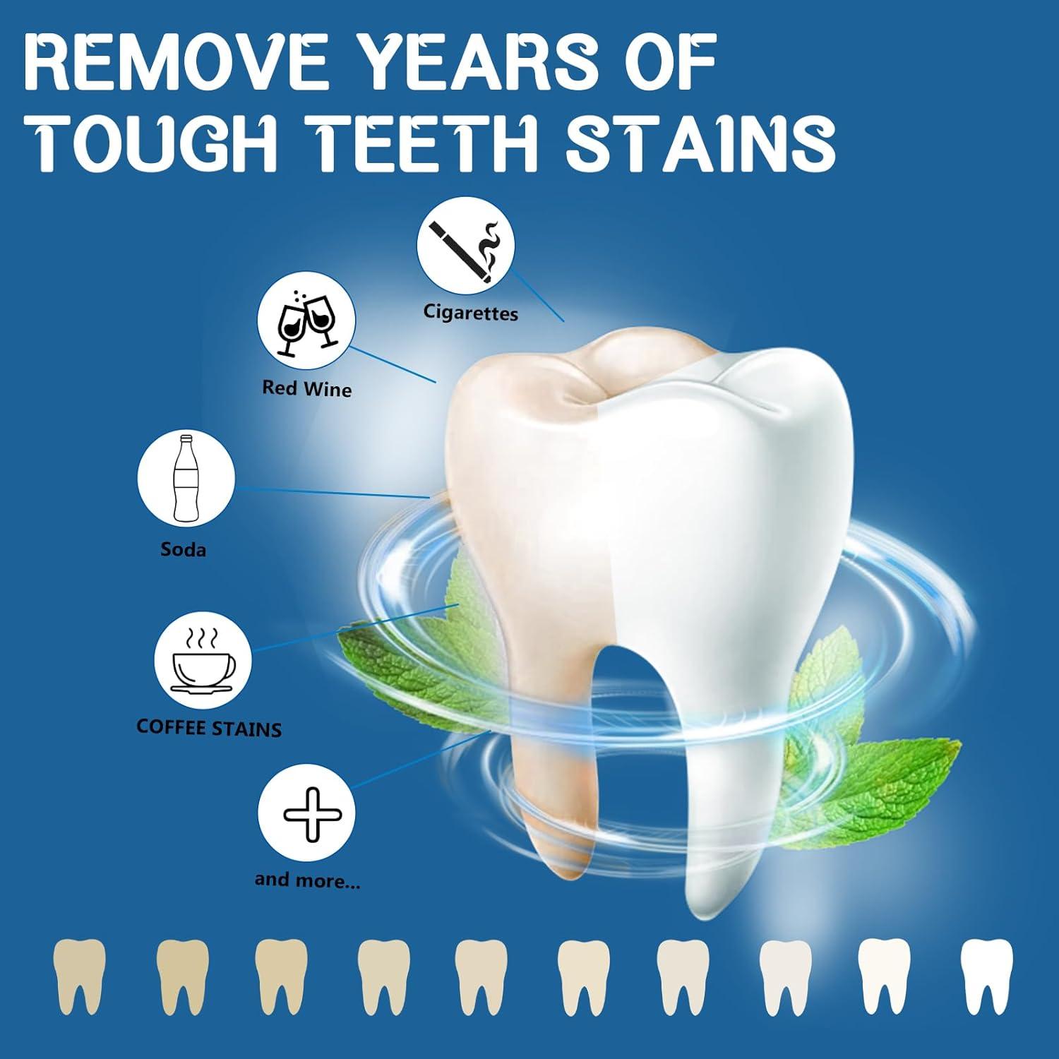 Tiras Blanqueadoras de Dientes ETCYAOXIN - 14 Tratamientos