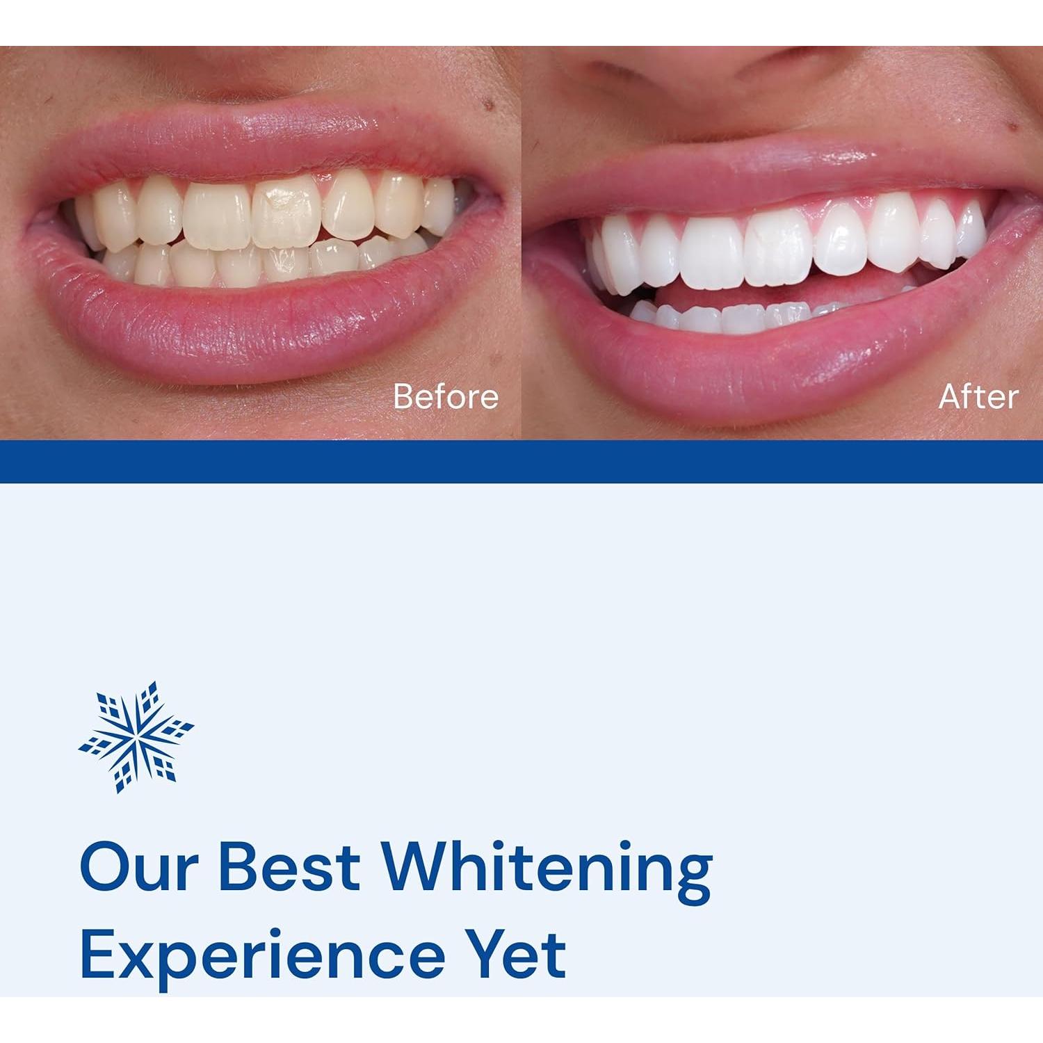 Kit Blanqueamiento Dental SNOW - Suero y Boquilla LED