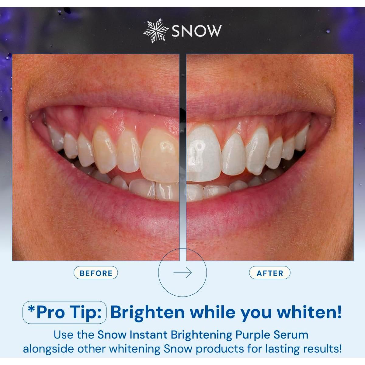 Suero Morado Blanqueador de Dientes SNOW - 60 Días de Uso