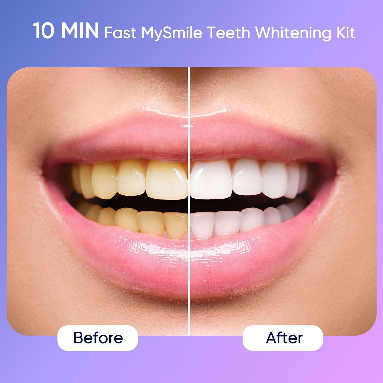Kit Blanqueamiento Dental MySmile Deluxe 10 Min 28 LED