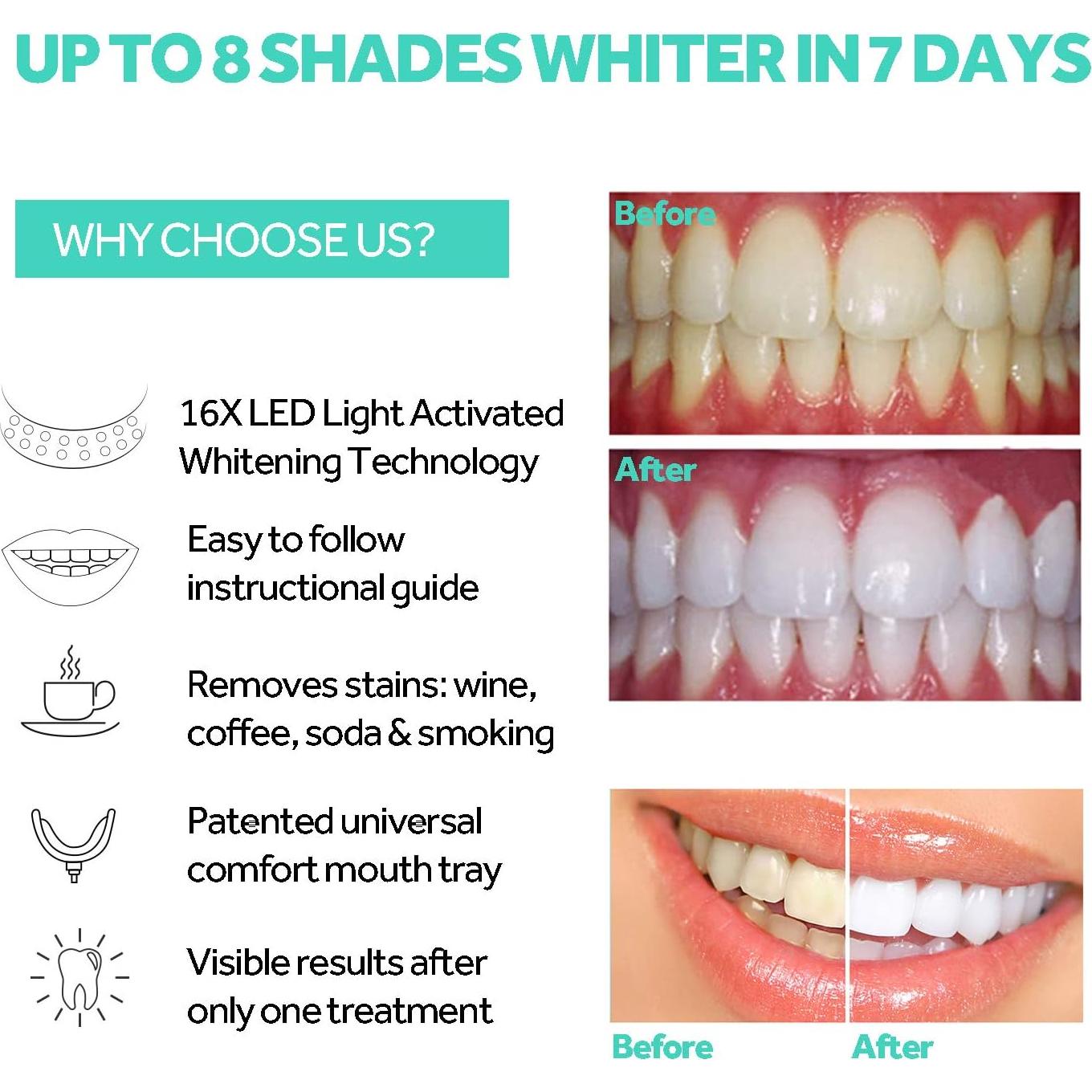 Acelerador Blanqueamiento Dental PHOEBE Luz LED Azul 16x