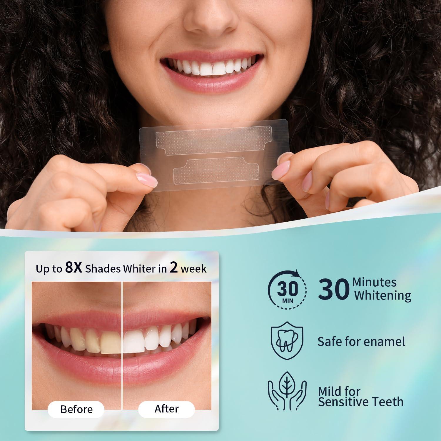 Kit Blanqueamiento Dental 7 Días Onuge - 14 Tiras + Lápiz