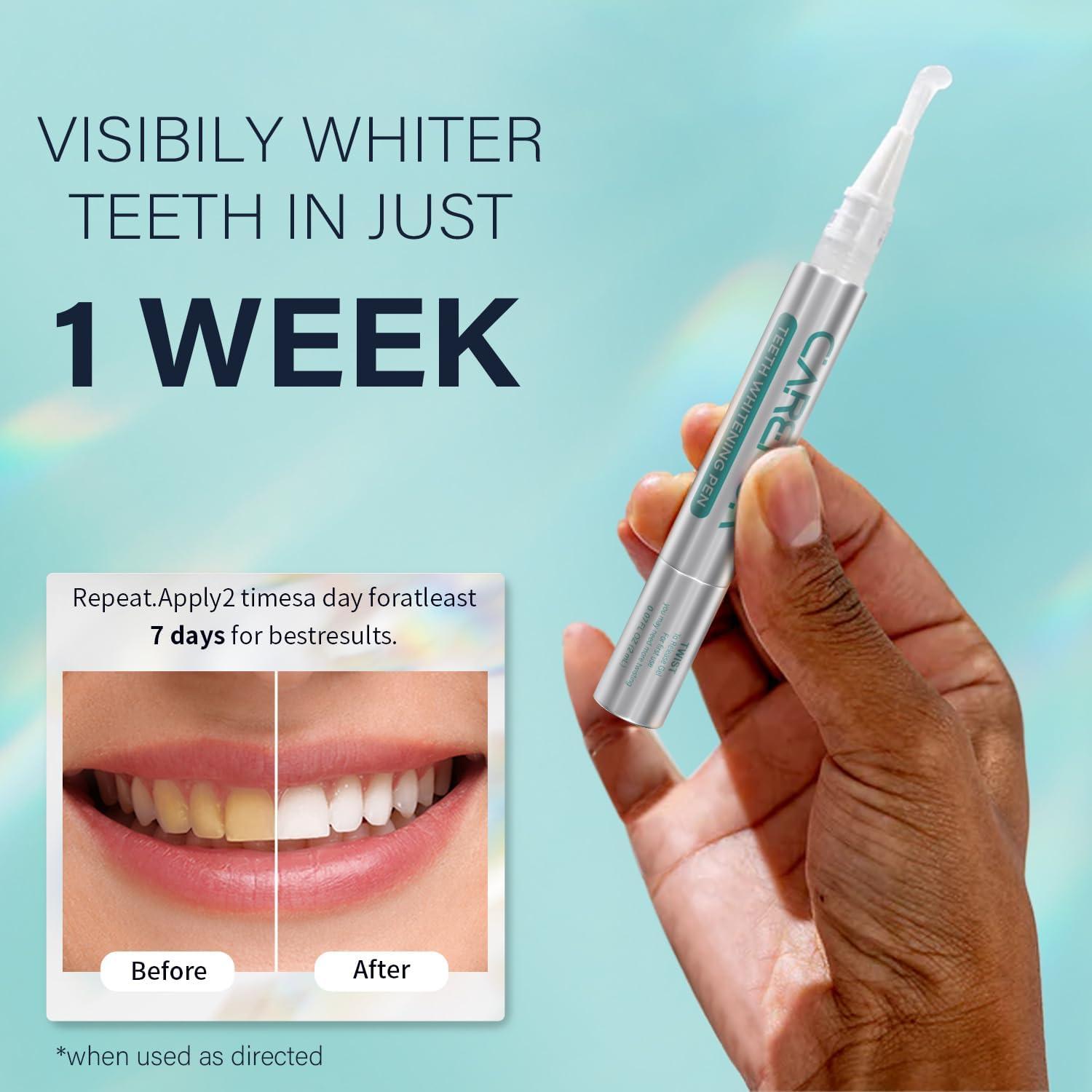 Kit Blanqueamiento Dental 7 Días Onuge - 14 Tiras + Lápiz