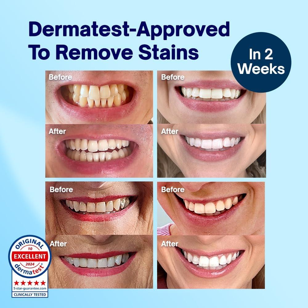 Polvo Blanqueador de Dientes MySweetSmile - Sin Peróxido