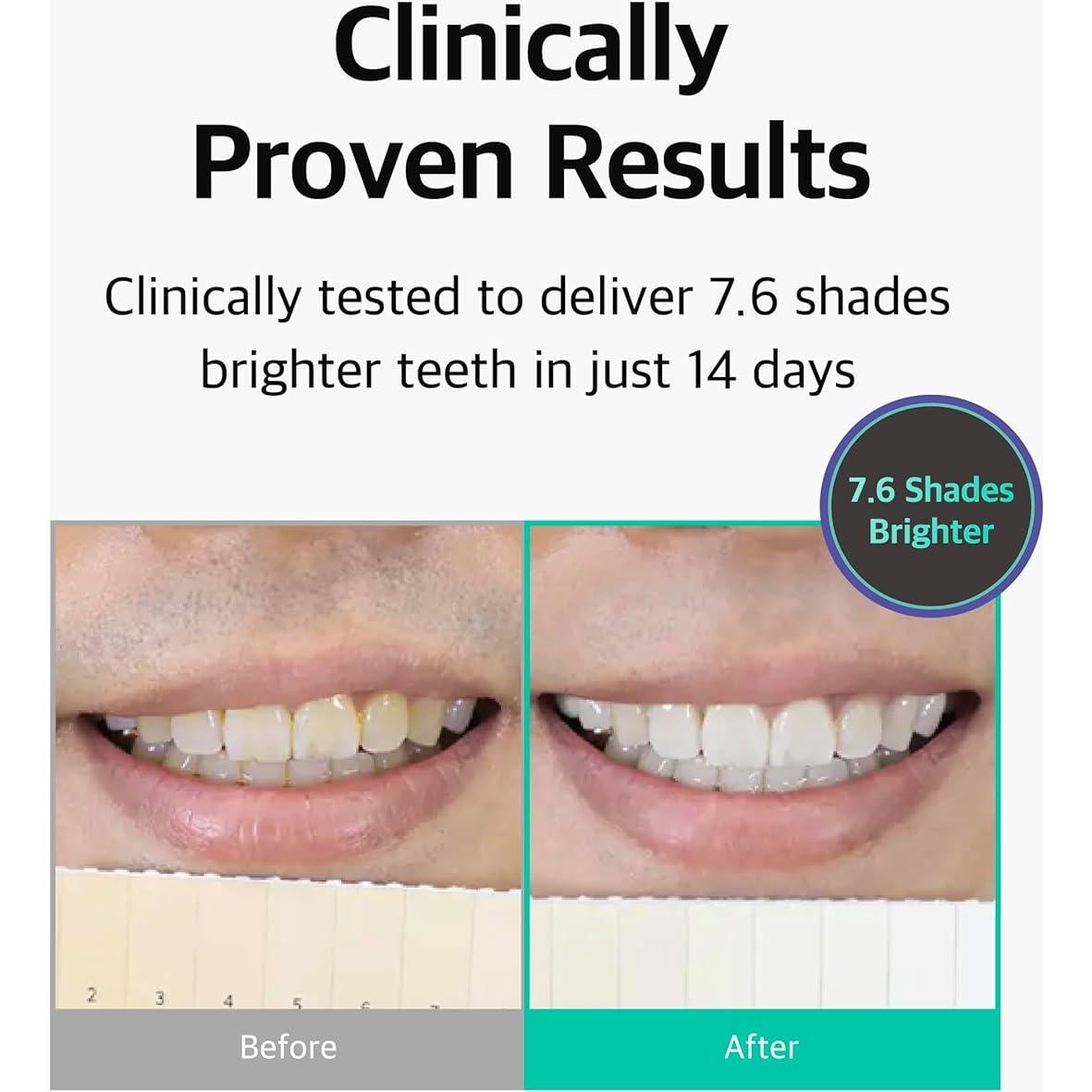 Kit Blanqueamiento Dental Live Orals PureDia - Gel y Boquilla