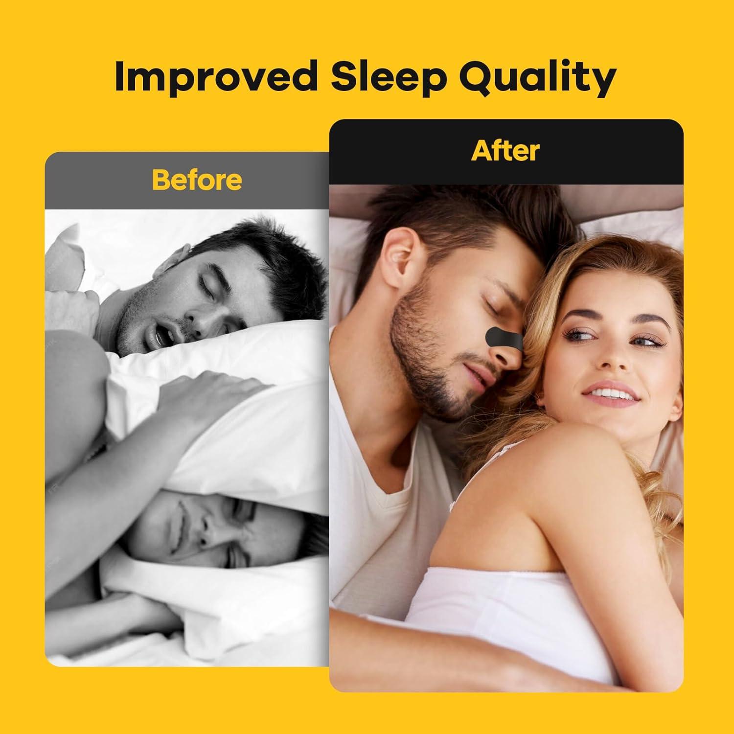 Tiras Nasales SleepSloth 36 Tiras Alivio Congestión Negro