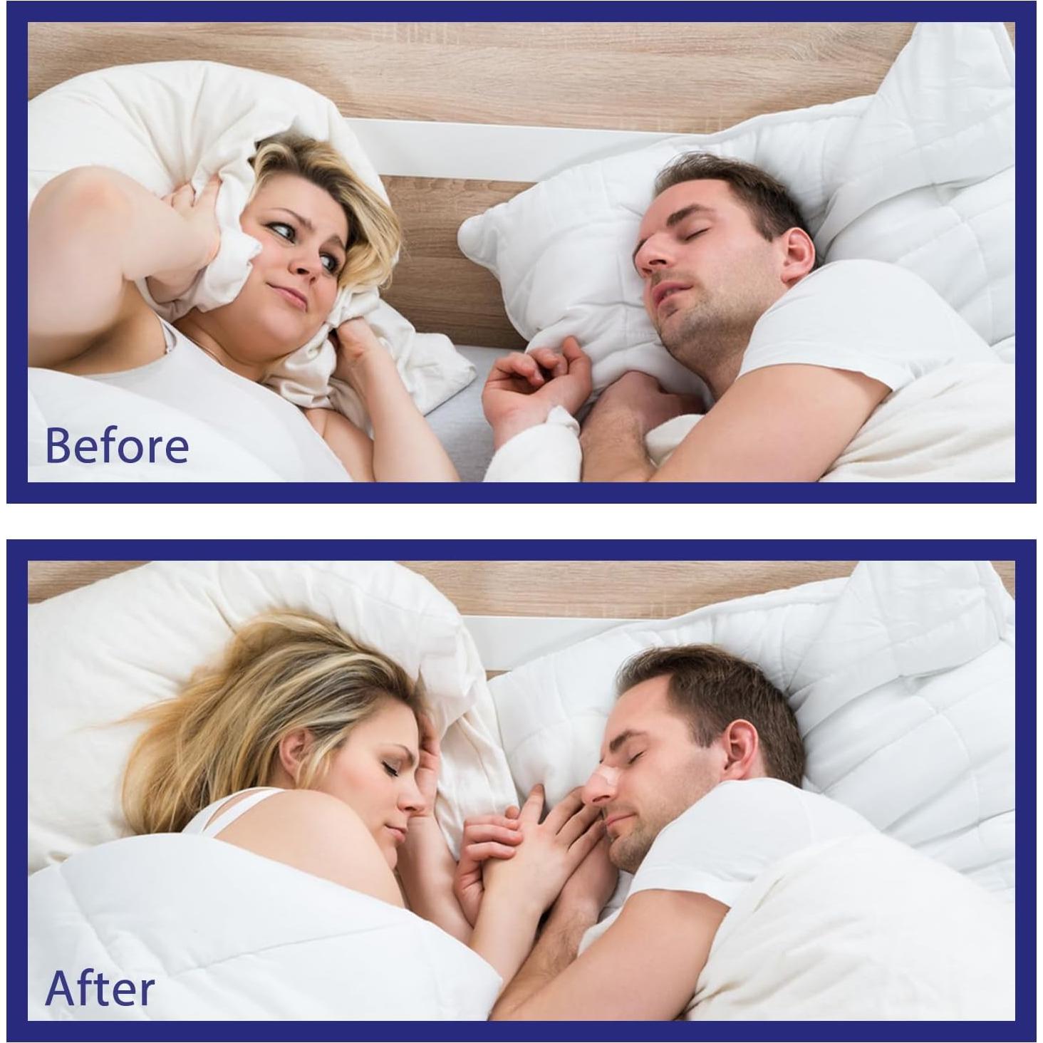 Tiras Nasales Transparentes DEBAISHI 30 Piezas 15.5x9.5cm