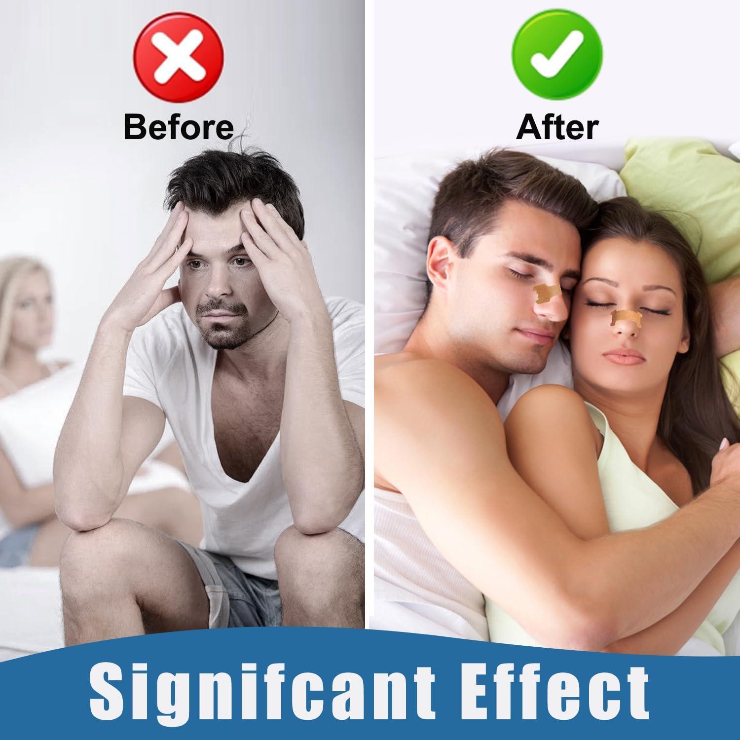 Tiras Nasales Tyelason Extra Grande 120 Unidades Alivio Ronquidos