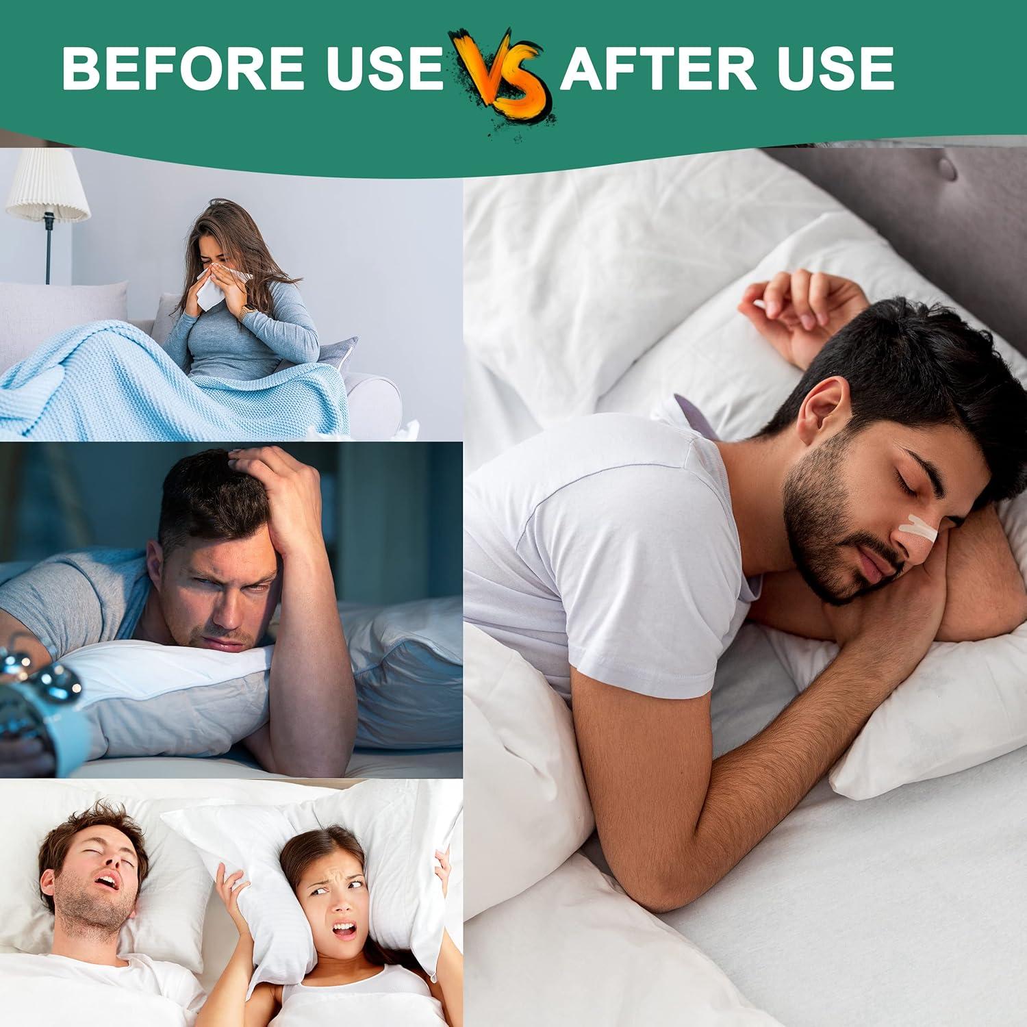 Tiras Nasales UPMOSTEK 120 Unidades Alivio Ronquidos