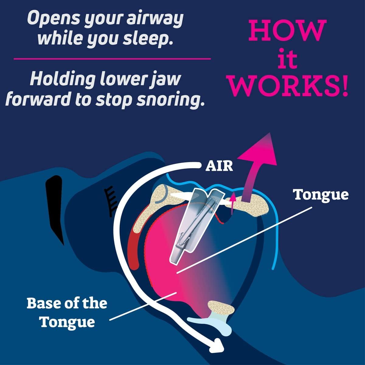 Dispositivo Anti Ronquidos SmartGuard Ajustable 109g