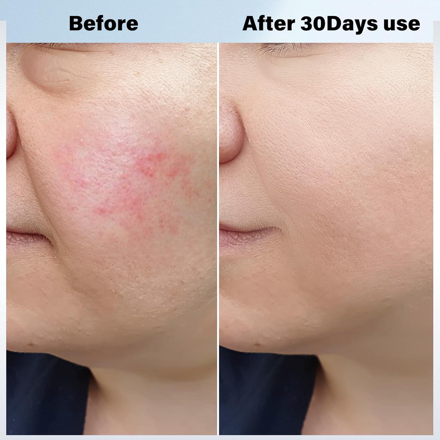 Masajeador Facial Vcycal Eléctrico Calor y Frío 38-47°C