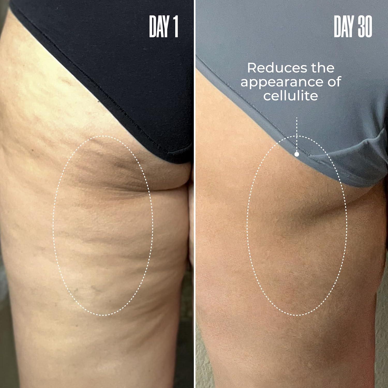 Máscara Anticelulitis B-TIGHT MAËLYS 15x7x15 cm 95g