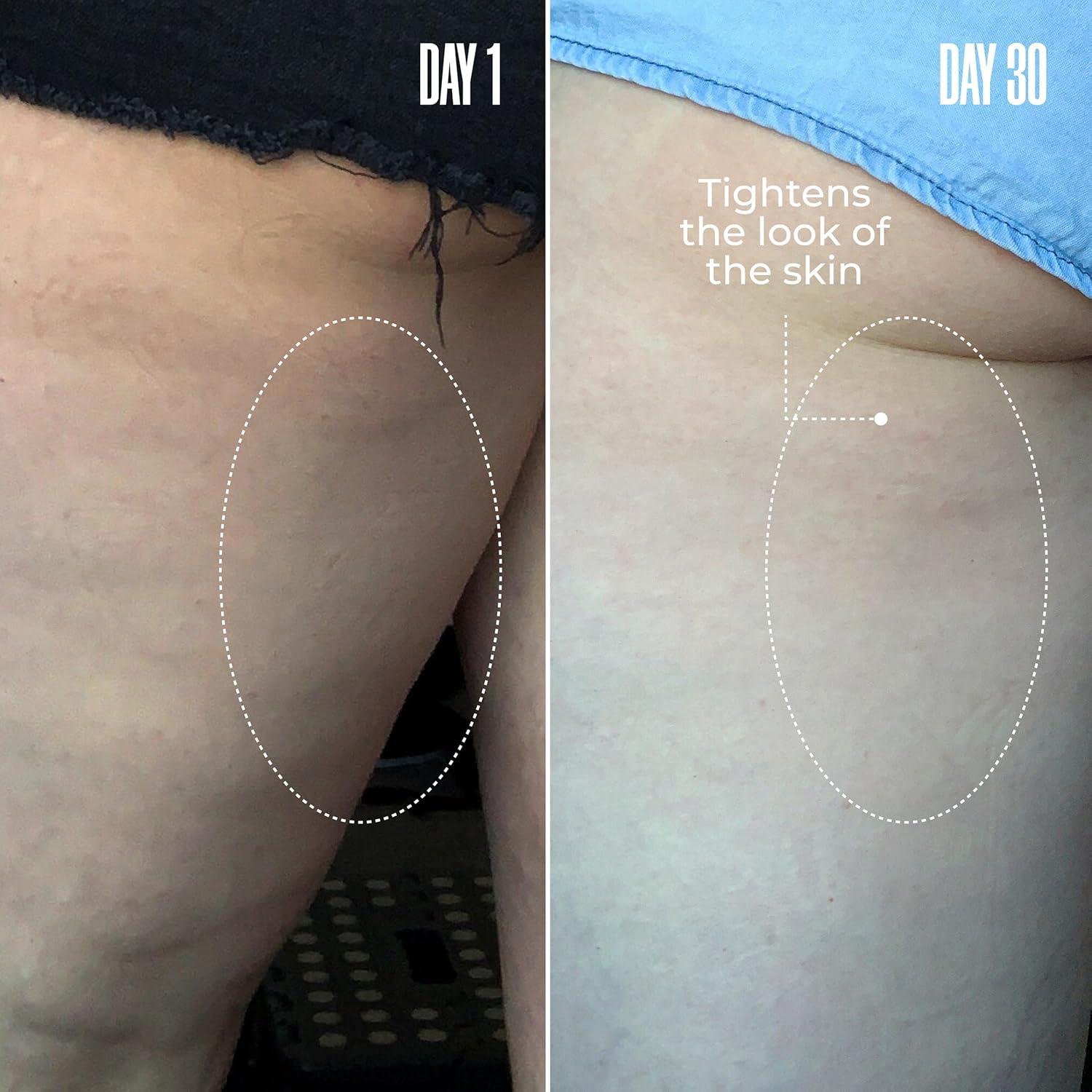 Máscara Anticelulitis B-TIGHT MAËLYS 15x7x15 cm 95g