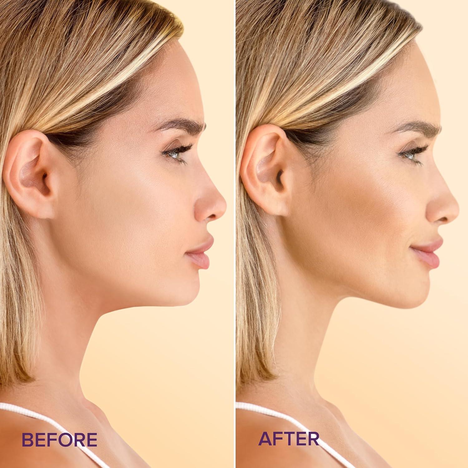 Máscara Elevadora V MAREE con Oro 24K - 5 Unidades