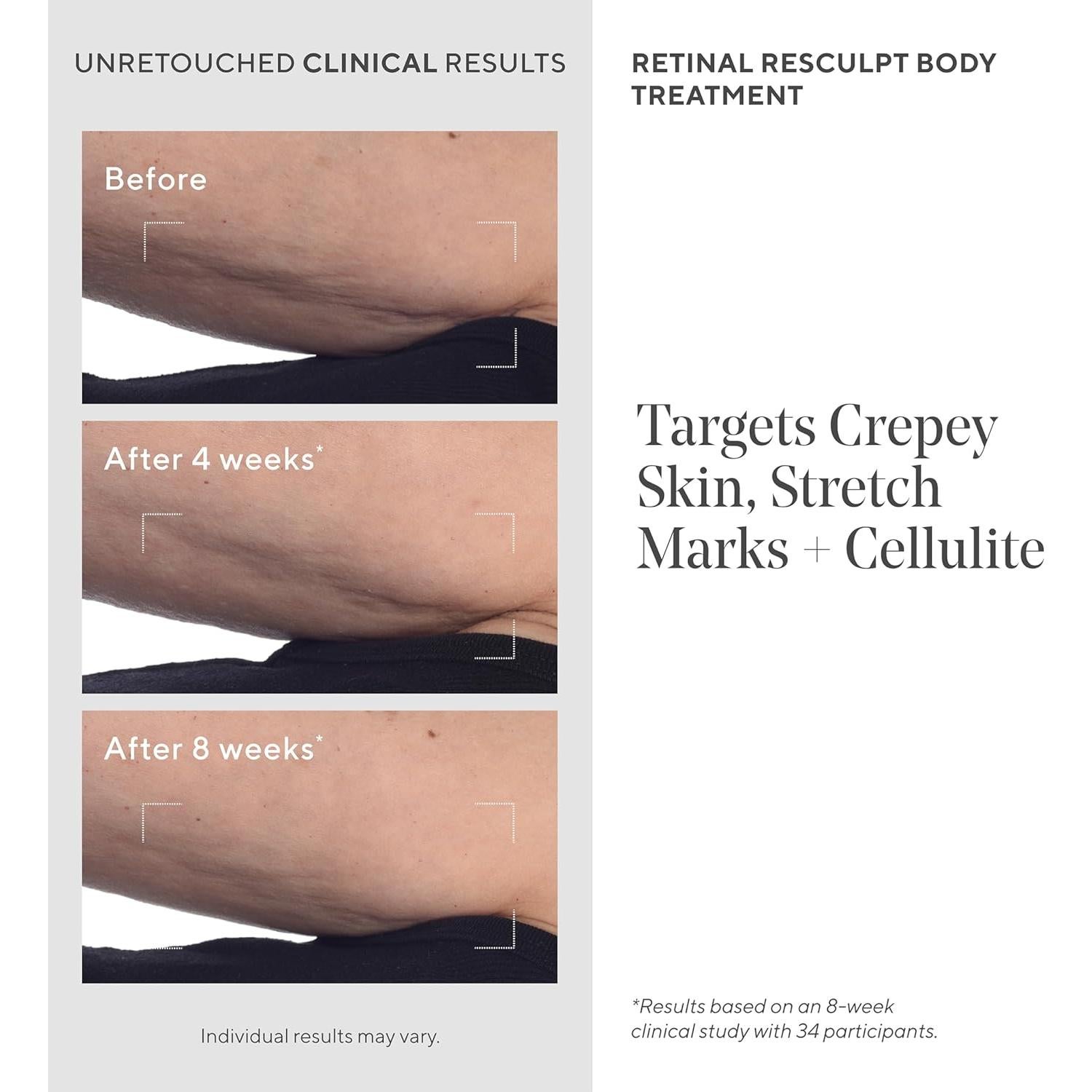 Crema Corporal Murad ReSculpt 150ml Anti-Celulitis y Estrías